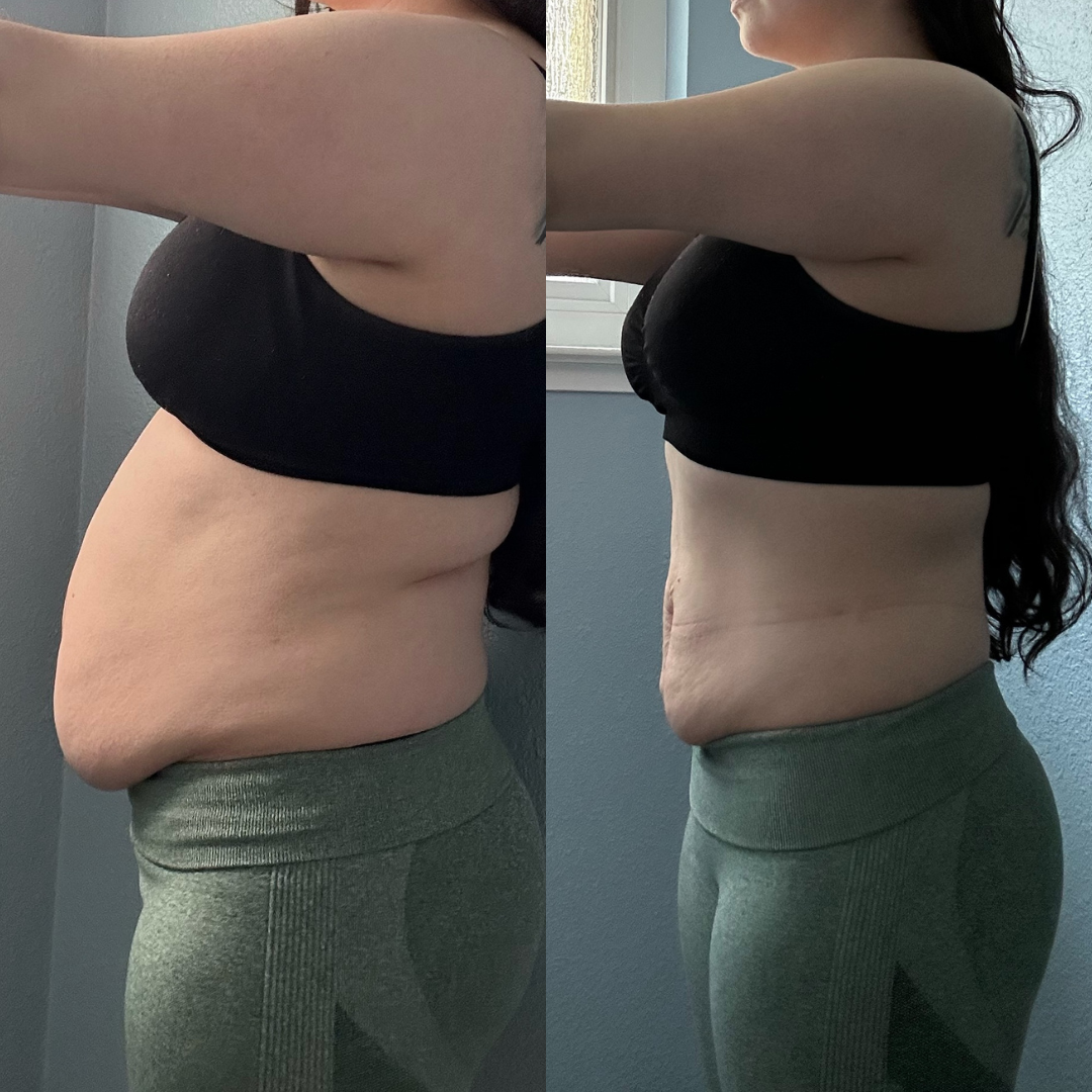 Bridal Before and Afters.png