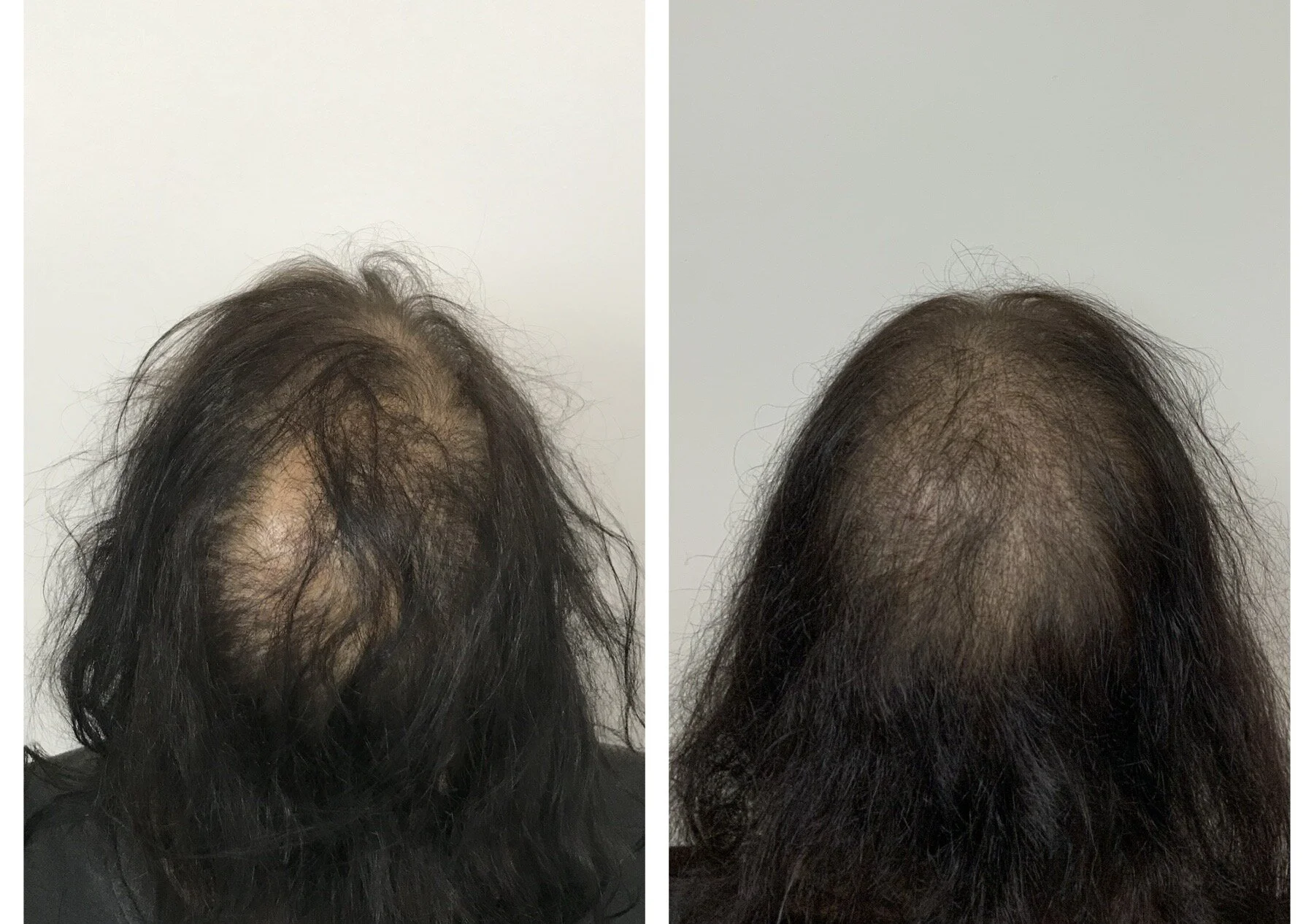 thinning long hair | thinning hair styles | fuller thicker hair with SMP