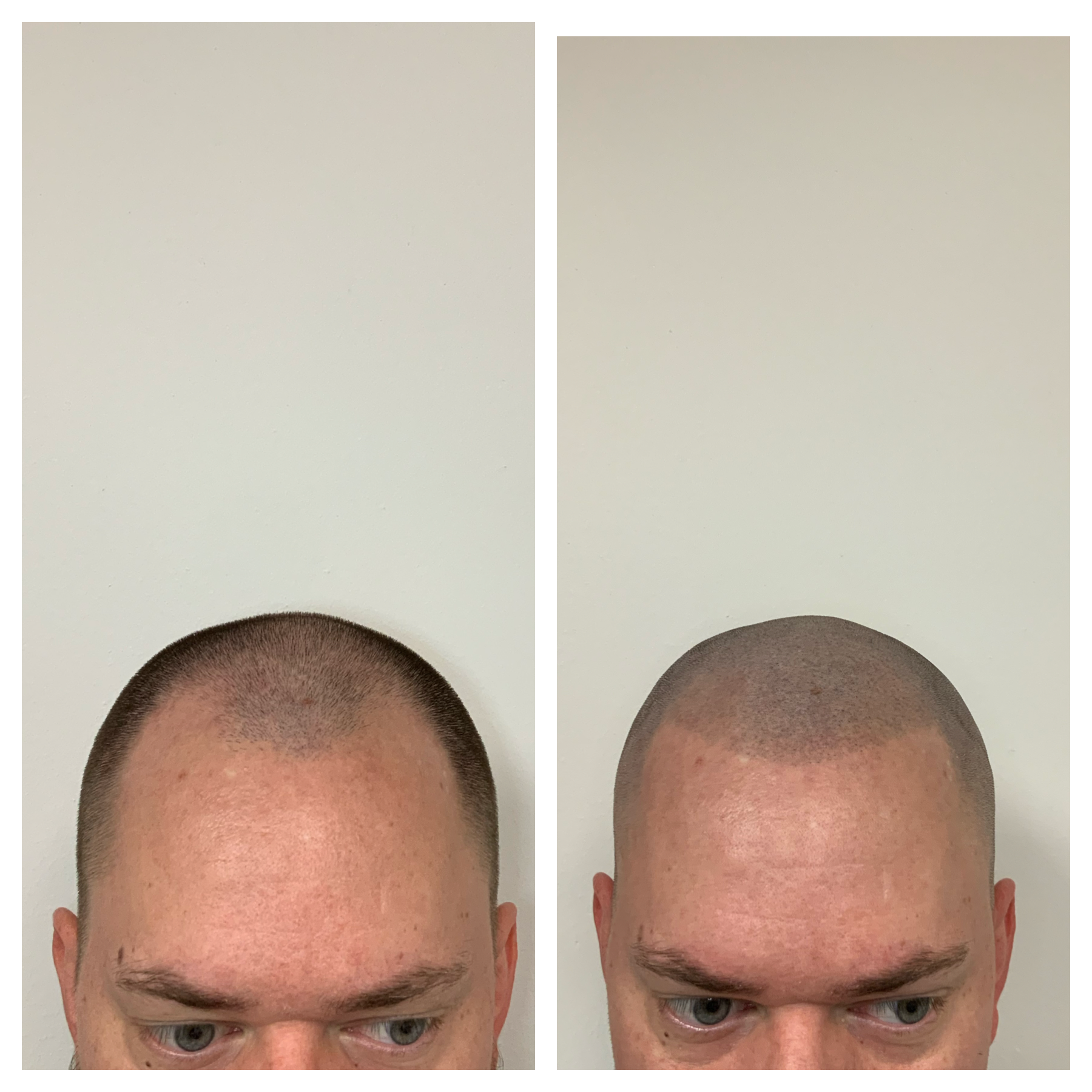 hair transformation in ok metro, hair treatment for men in oklahoma 