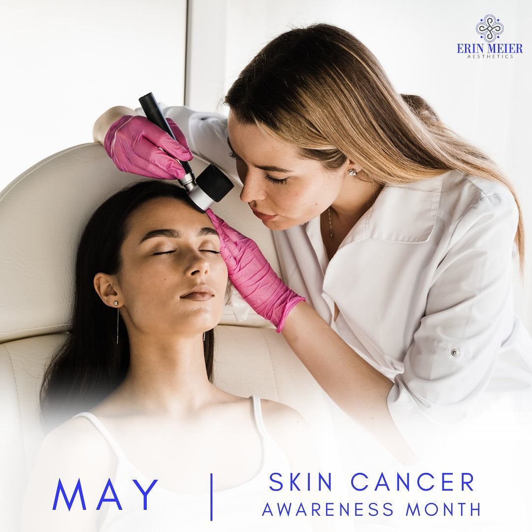 🎗️ May is Skin Cancer Awareness Month 🌞💛
As the sun starts shining brighter, it&rsquo;s crucial to remember the importance of sun safety and regular skin checks. Skin cancer is highly preventable and, if caught early, highly treatable! 👩&zwj;⚕️
?