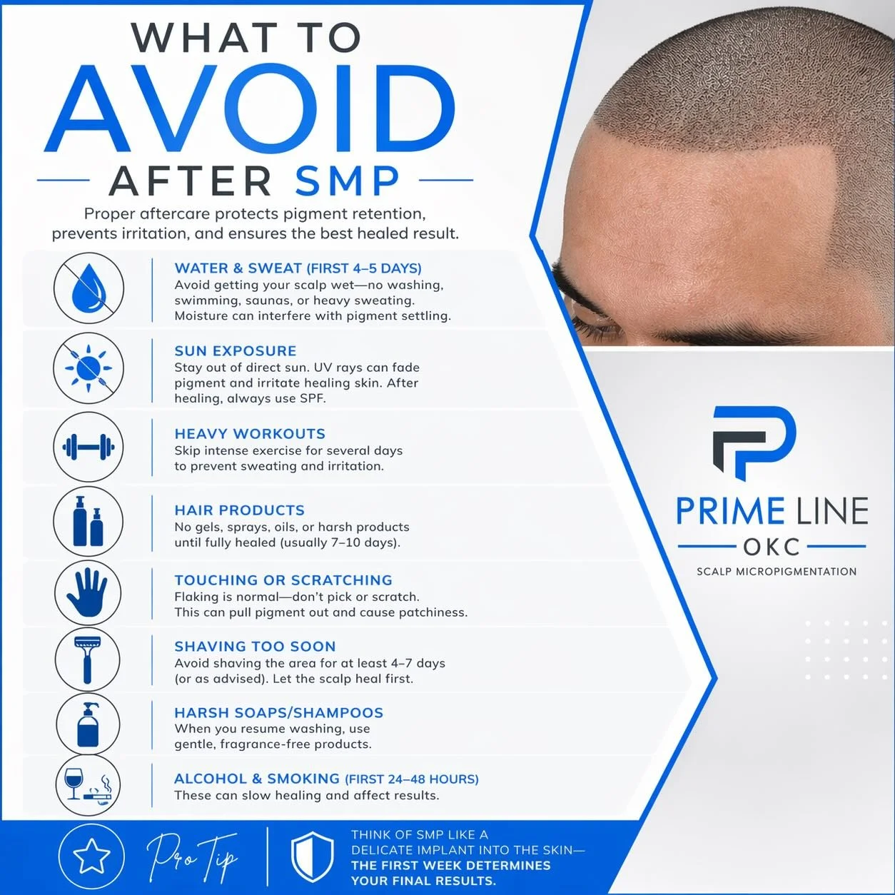 🚫 What to Avoid After SMP

💧 Water &amp; Sweat (First 4&ndash;5 Days)
Avoid getting your scalp wet&mdash;no washing, swimming, saunas, or heavy sweating. Moisture can interfere with pigment settling.

☀️ Sun Exposure
Stay out of direct sun. UV rays