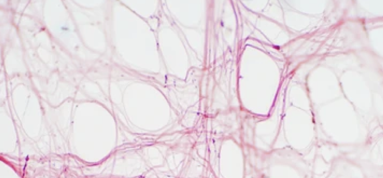 Fascia - A Uniting Principle in Wellbeing 