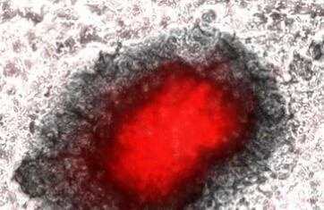    Scientists closer to making implantable bone material