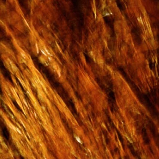 Bone microstructure