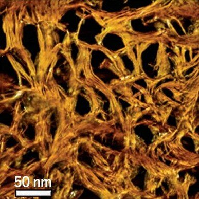 Microcope image showing cellular structure of bone