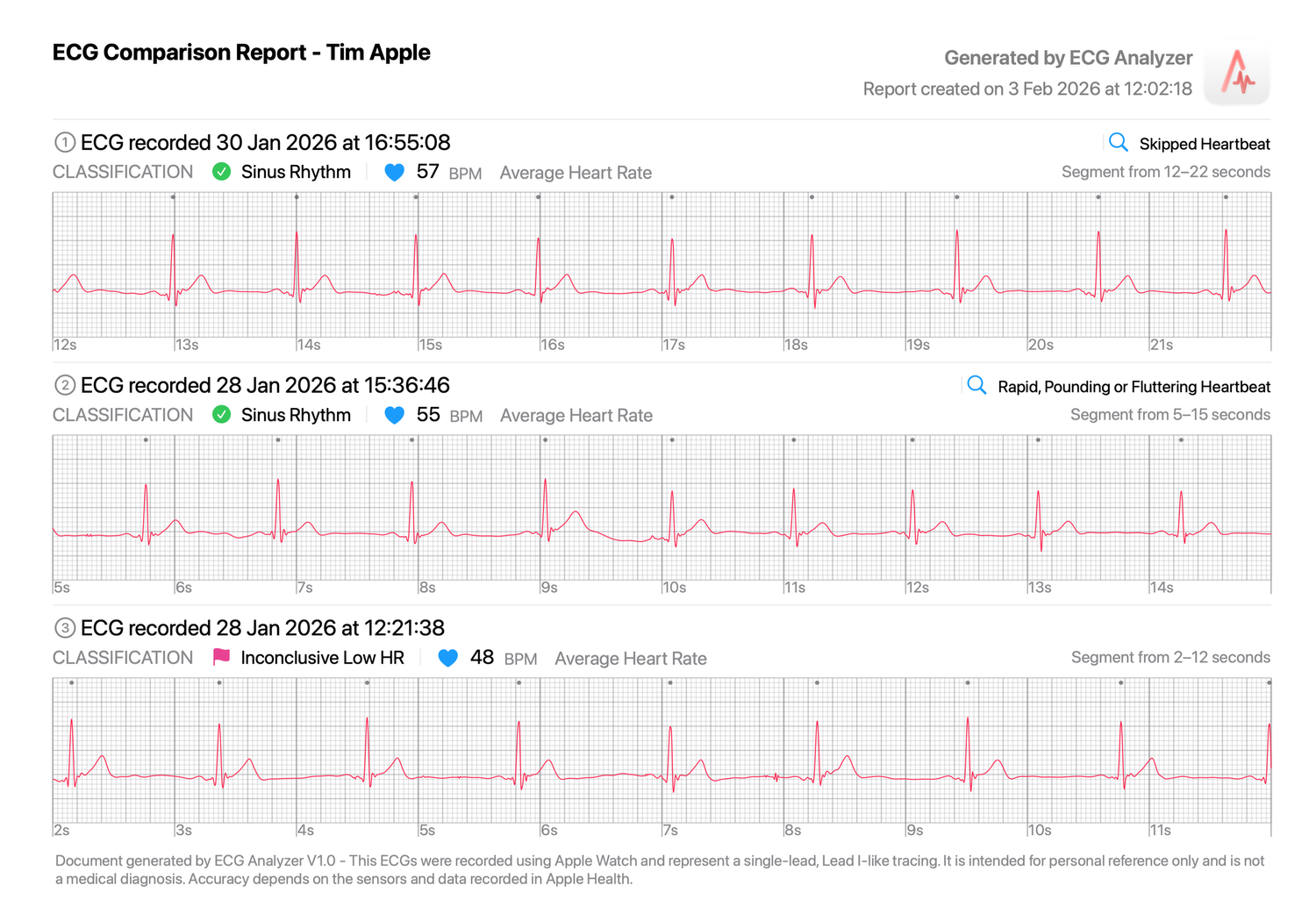 ECG Analyzer — Helix Apps