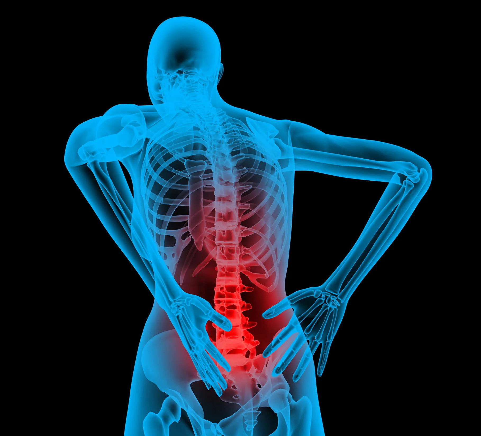How to Keep Training with Back Pain