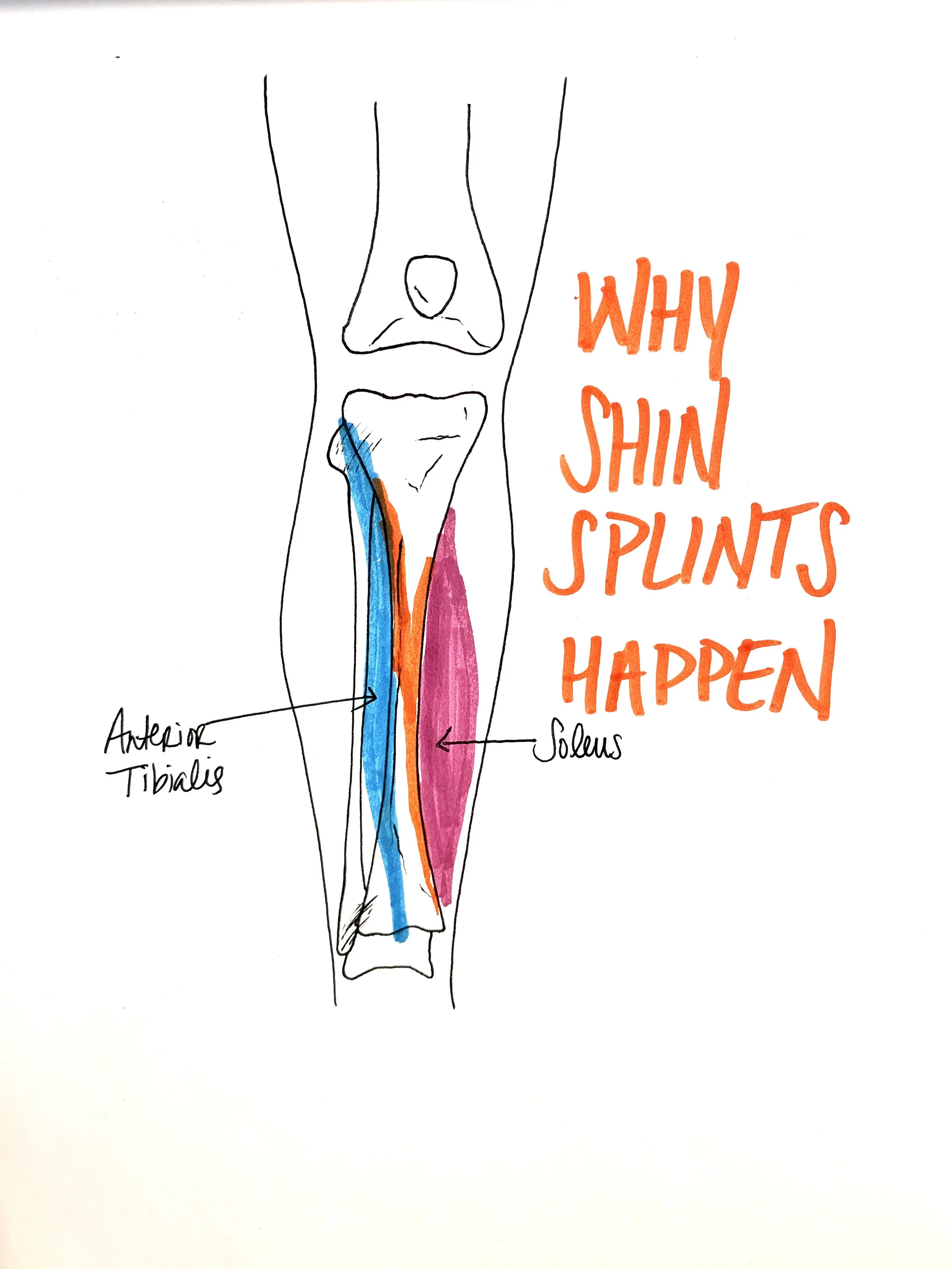 Shin Splints Recovery and Prevention