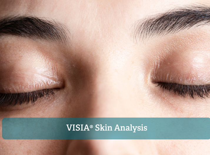 VISIA® Skin Analysis