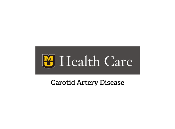 Carotid Artery Disease