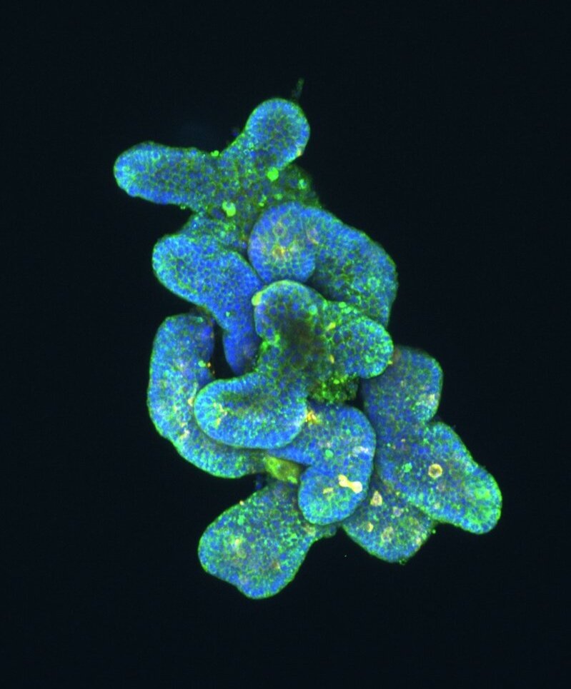 Organoide – Mini-Organe in der Petrischale für die Krebs- &amp; Corona-Forschung
