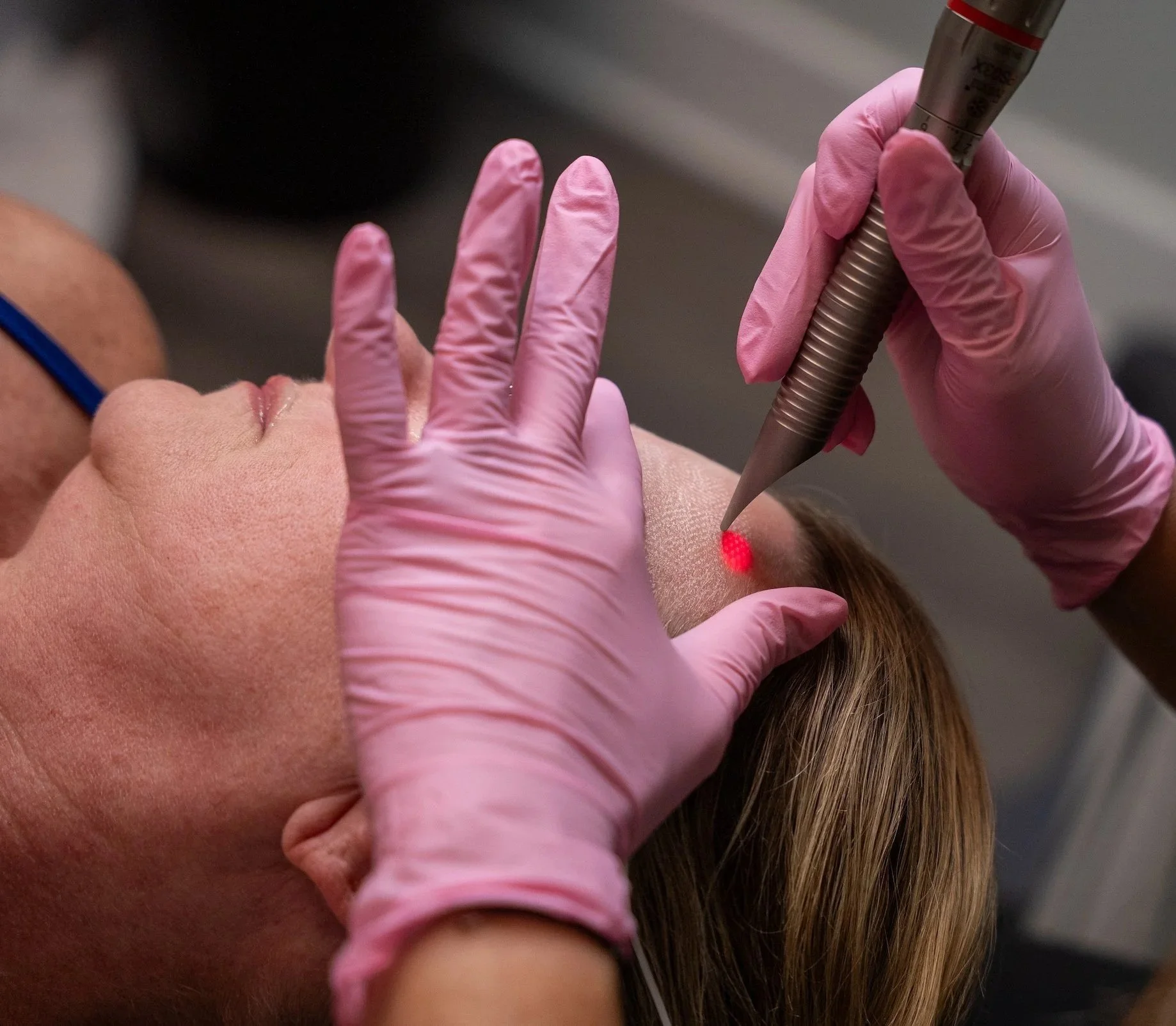 Image of a woman receiving Fotona 4D Laser Treatment. 