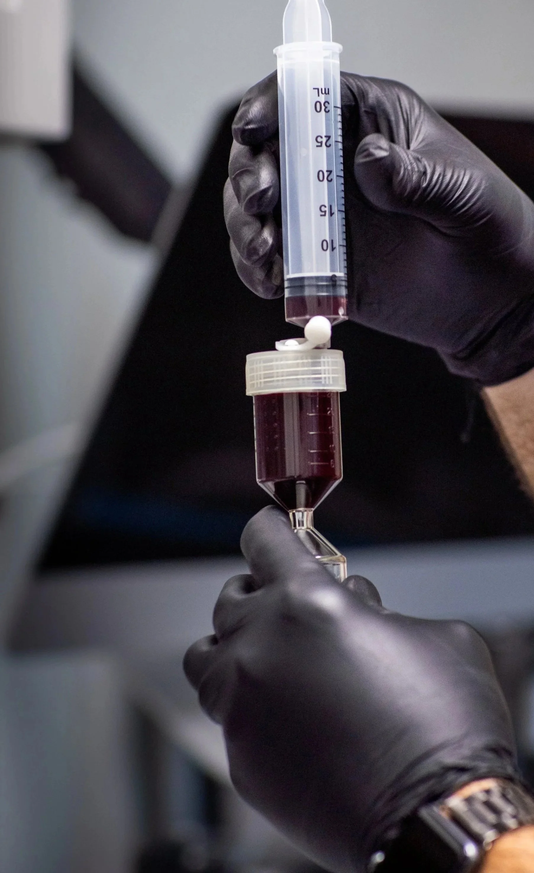 Image of a man drawing PRP into a syringe.
