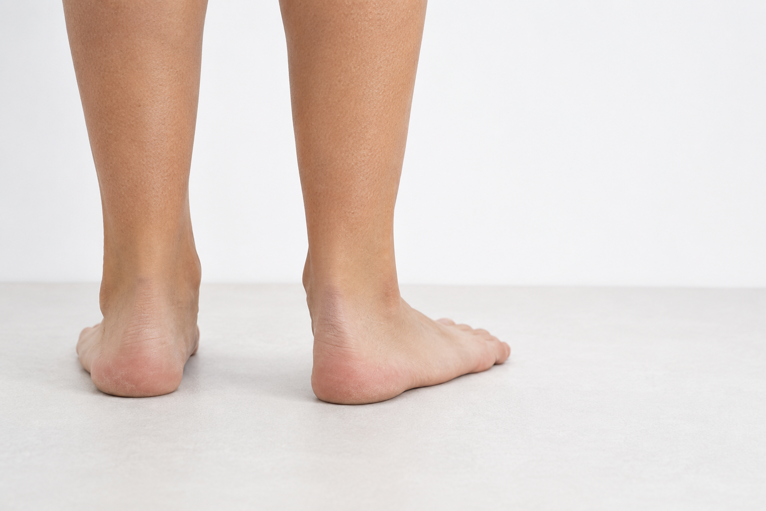 Flatfeet