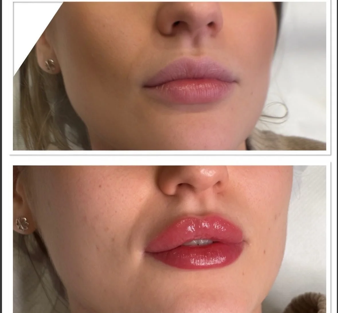 𝐓𝐡𝐢𝐬 𝐢𝐬 𝐲𝐨𝐮𝐫 𝐬𝐢𝐠𝐧 𝐭𝐨 𝐛𝐨𝐨𝐤 𝐭𝐡𝐞 𝐥𝐢𝐩 𝐛𝐥𝐮𝐬𝐡 𝐲𝐨𝐮&rsquo;𝐯𝐞 𝐛𝐞𝐞𝐧 𝐰𝐚𝐧𝐭𝐢𝐧𝐠 𝐭𝐨 𝐠𝐞𝐭 💉✨💋

Lip blush is the perfect way to add colour, shape &amp; definition to your lips, once they have healed the colour will