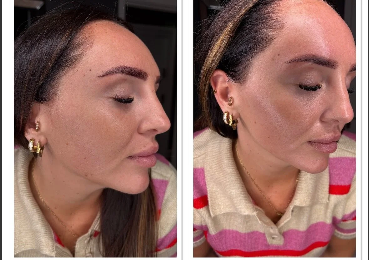✨That hydro facial glow ✨