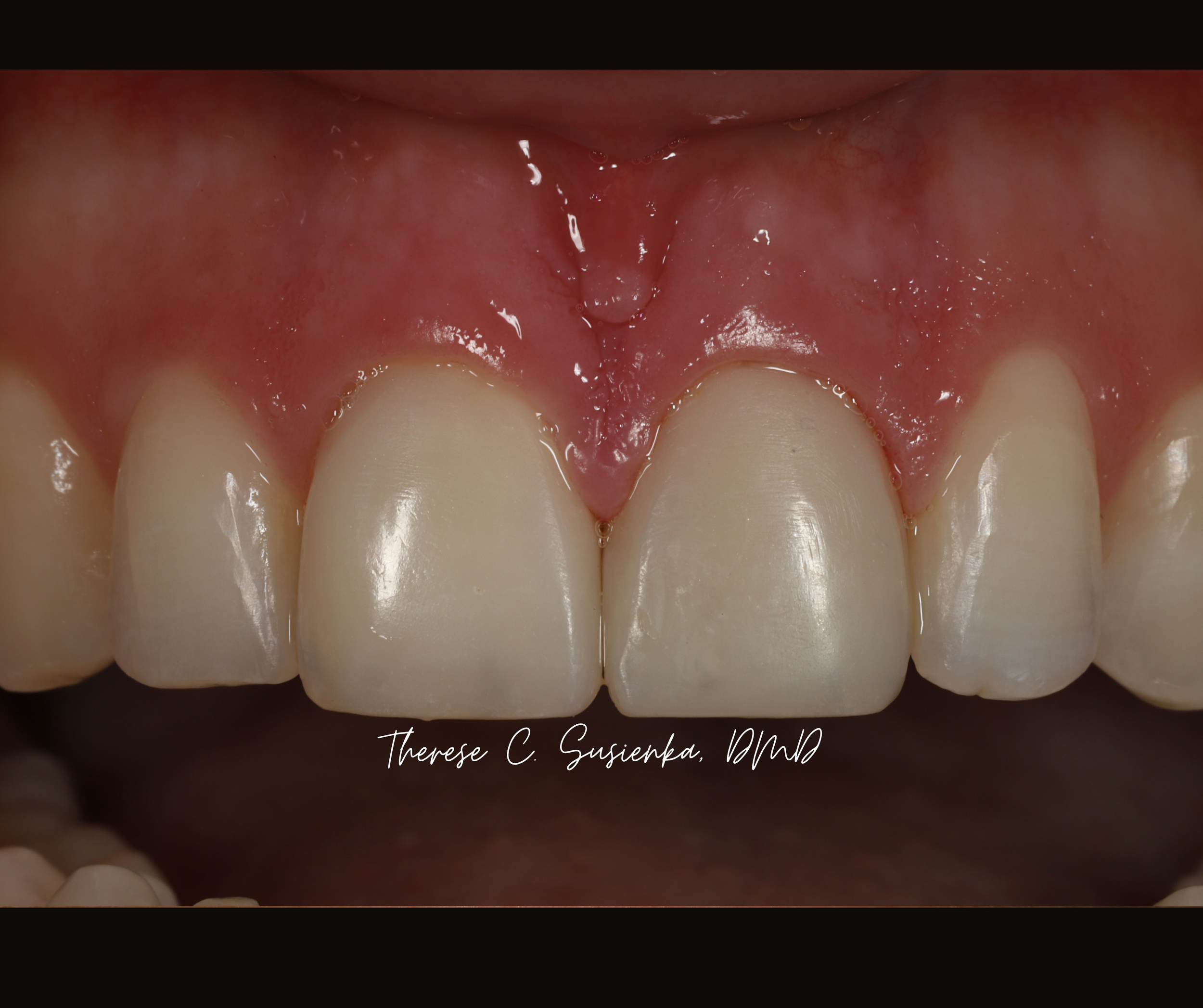 Copy of Facebook Template Before & After (19).png