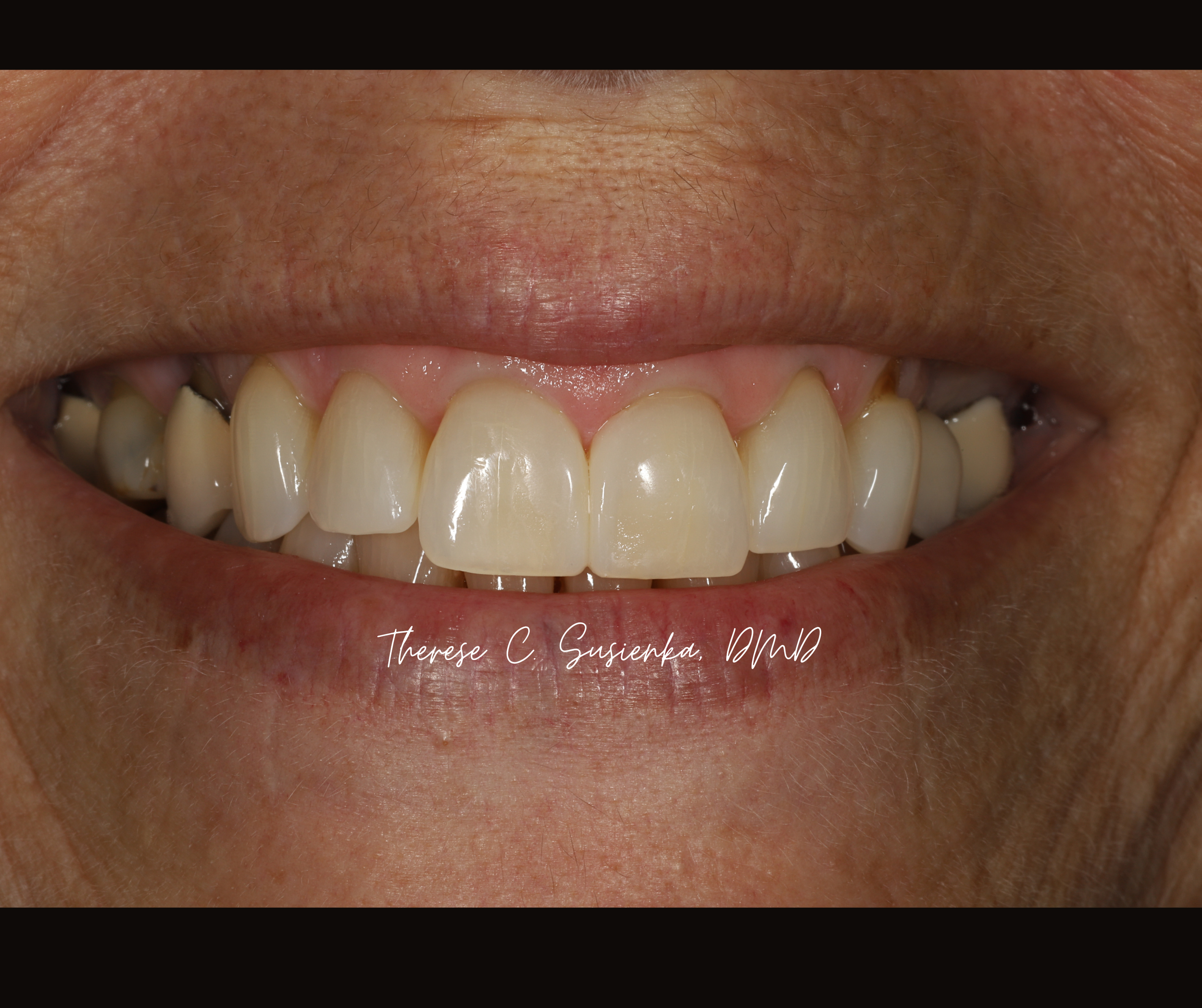 Copy of Facebook Template Before & After (17).png