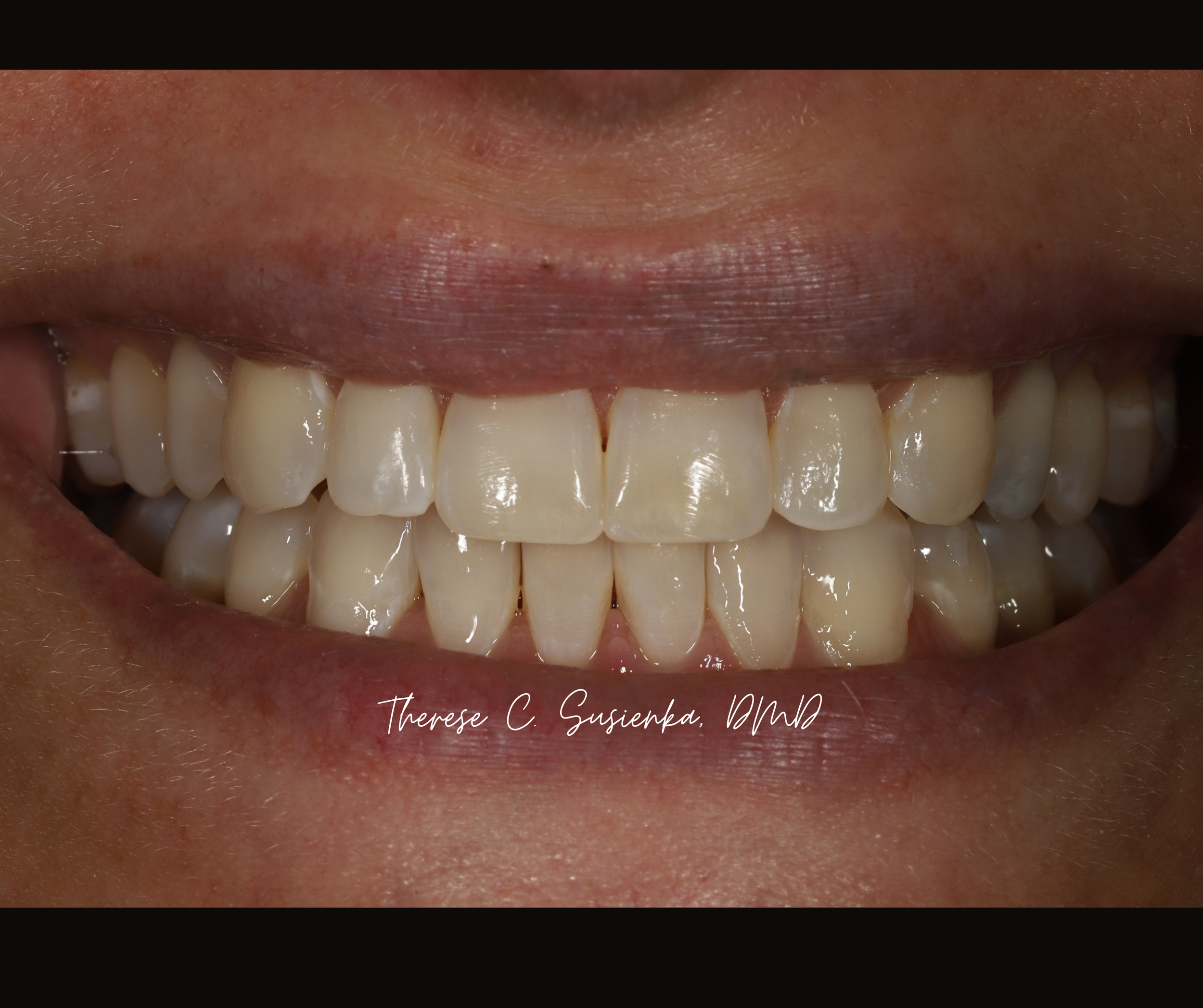 Copy of Facebook Template Before & After (18).png