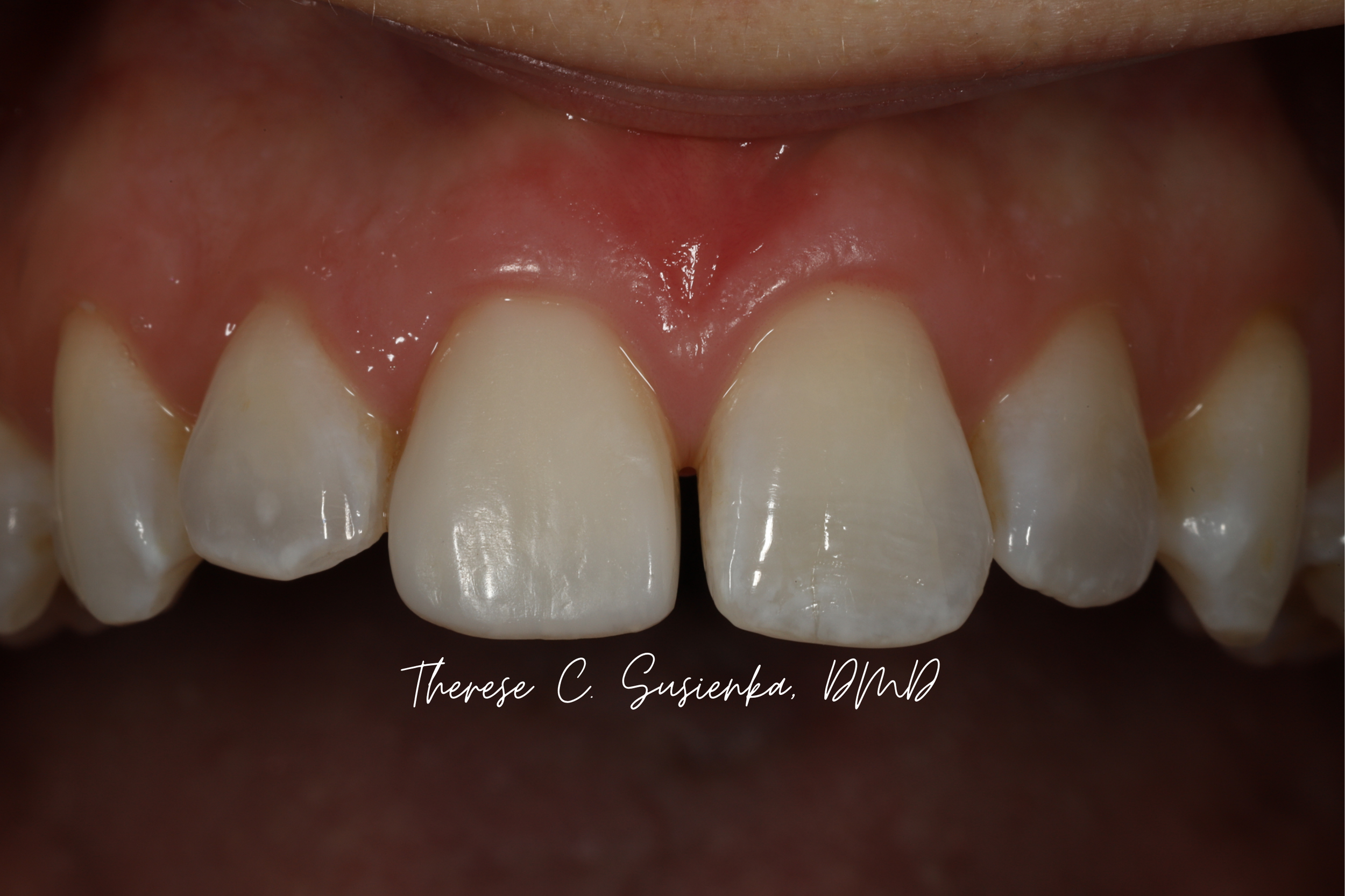 Website template (3 x 2 in) (1).png