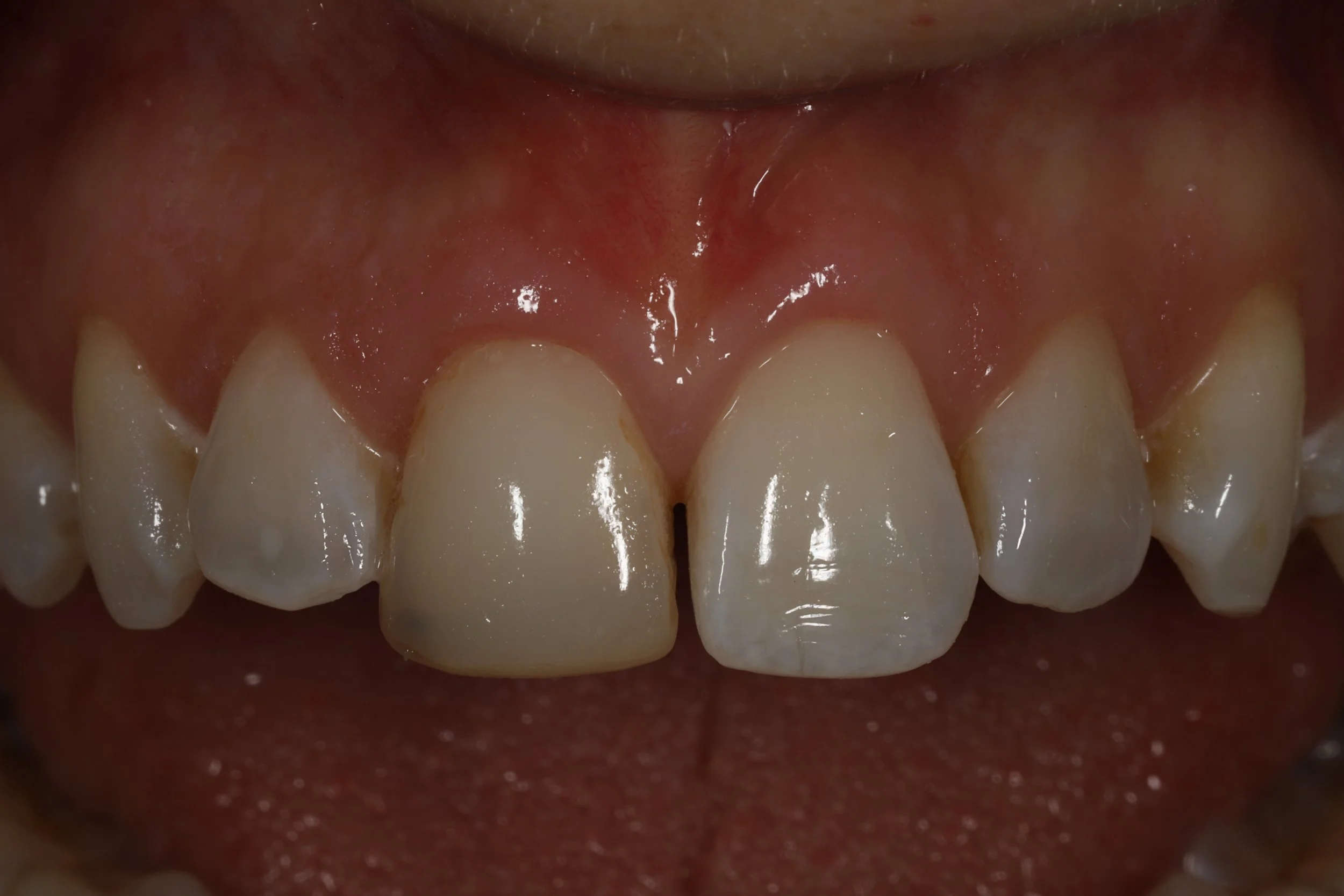 3. before close up.JPG