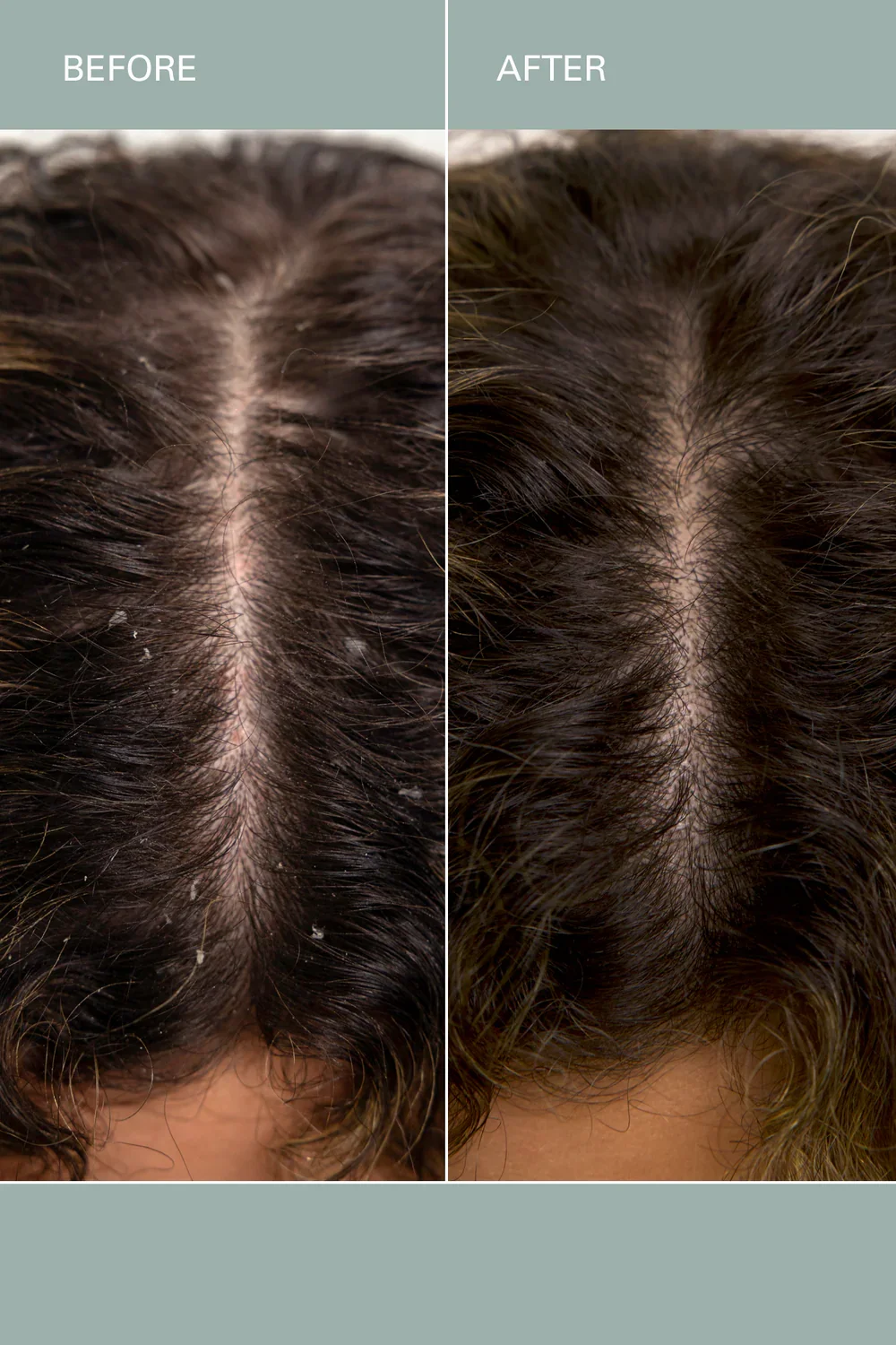 Roz_Salt_Scalp_Scrub-Plume_Salon-BA_7_1000x.png.webp