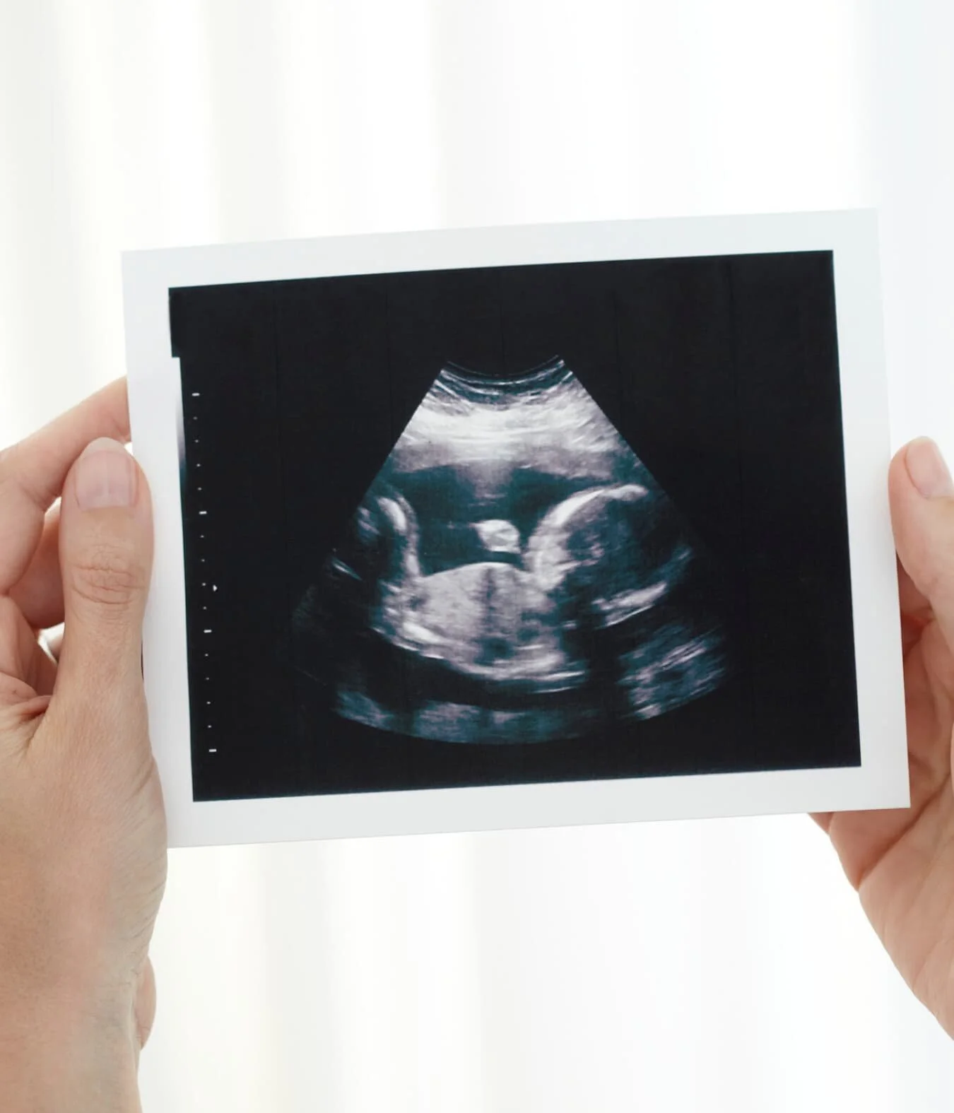 The Abortion Of Human Rights