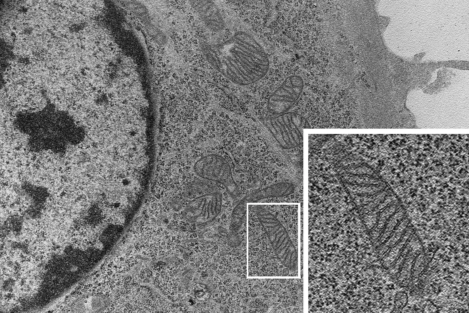 Nucleus Electron Micrograph
