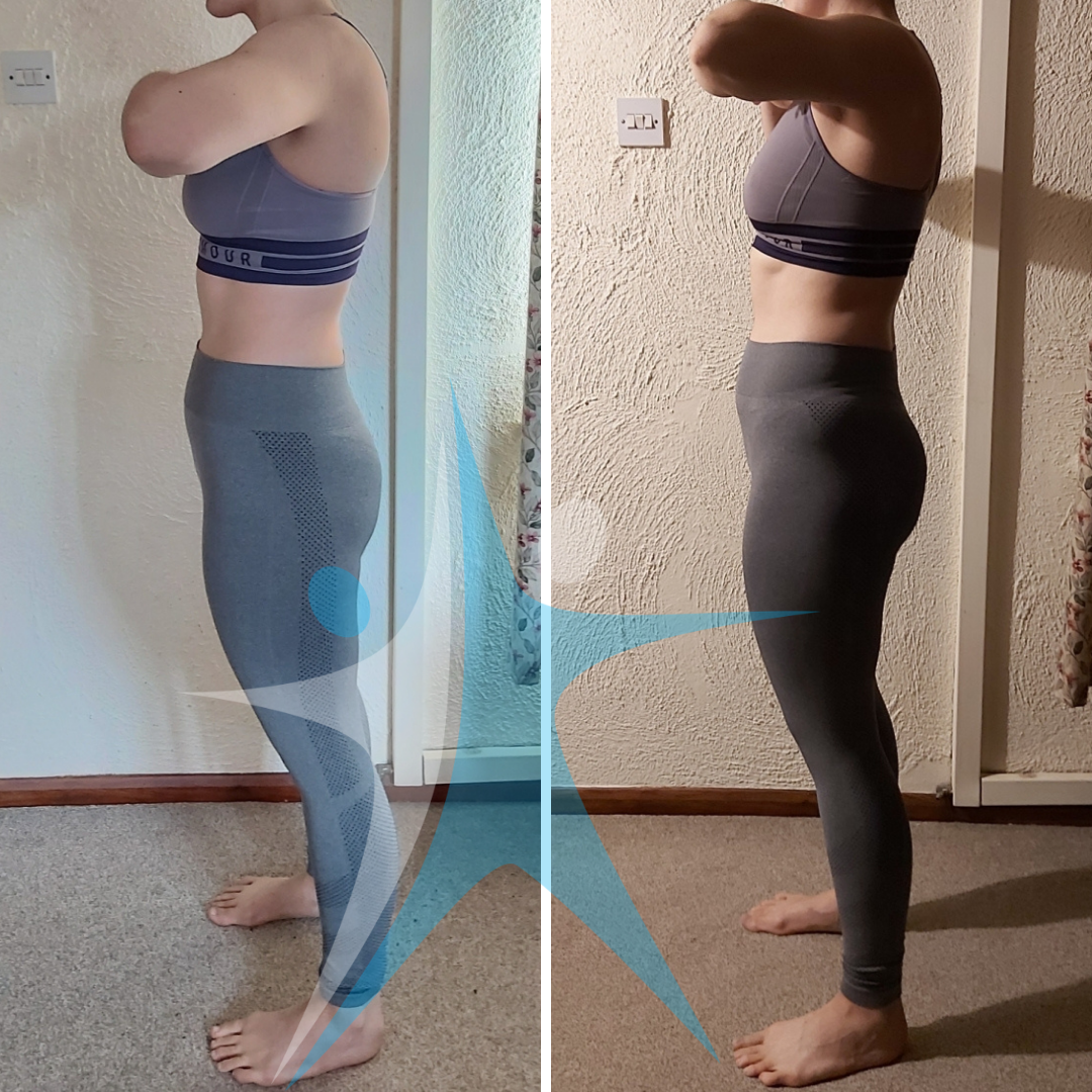How To Get Rid Of Hip Dips Why They Are Not An Issue Aaron 