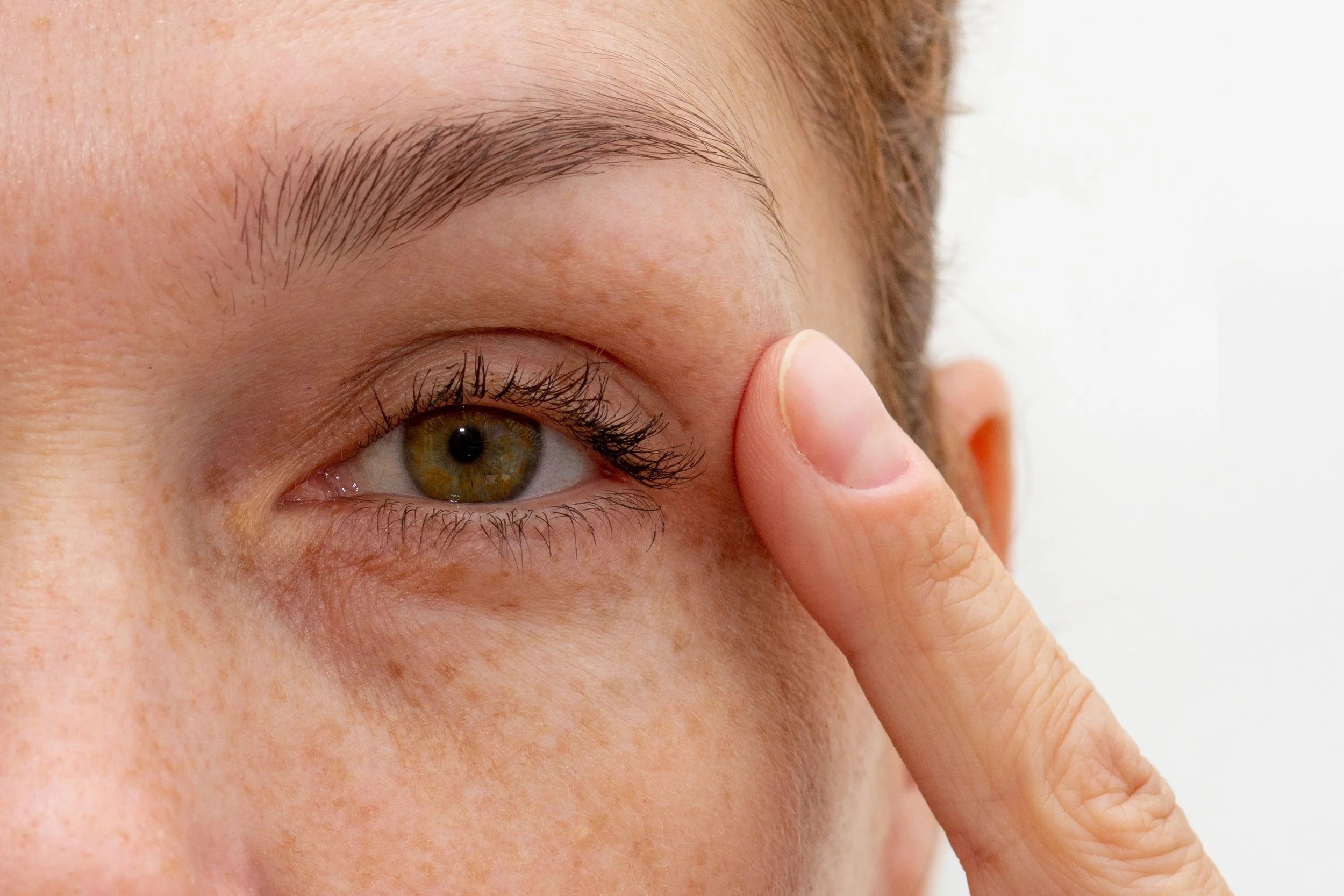 Is Eyelid Surgery Right for You? Benefits, Risks &amp; Ideal Candidates