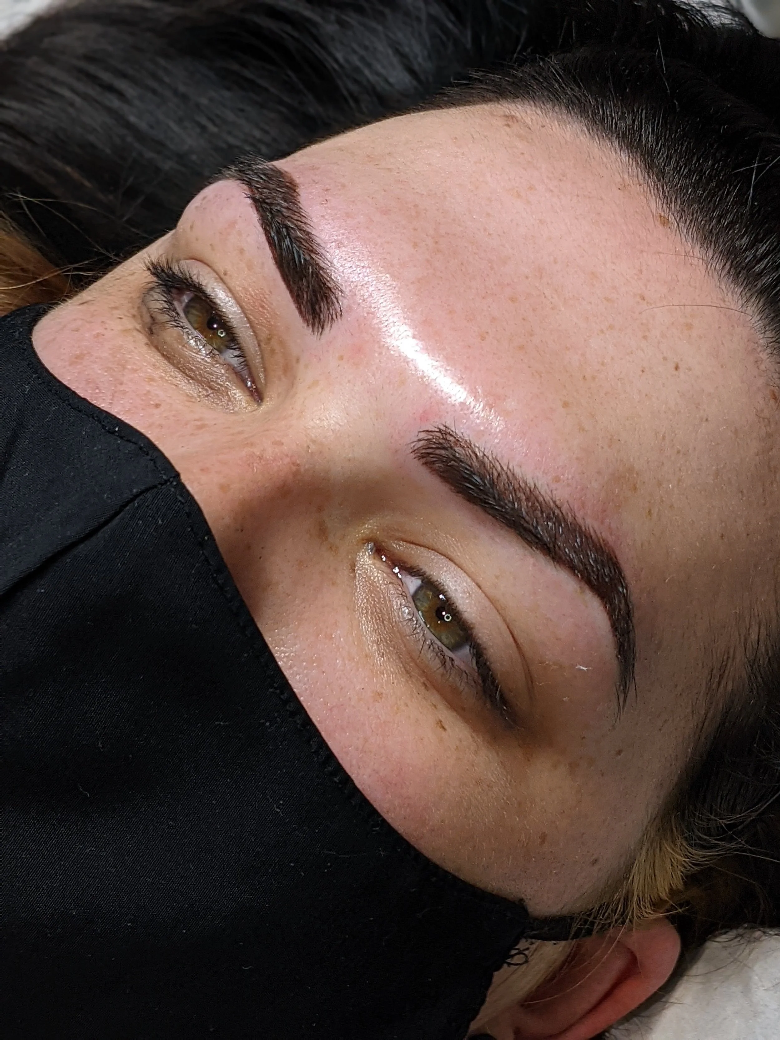 Botox treatment North East – Nurse Sarah performing anti-wrinkle injections