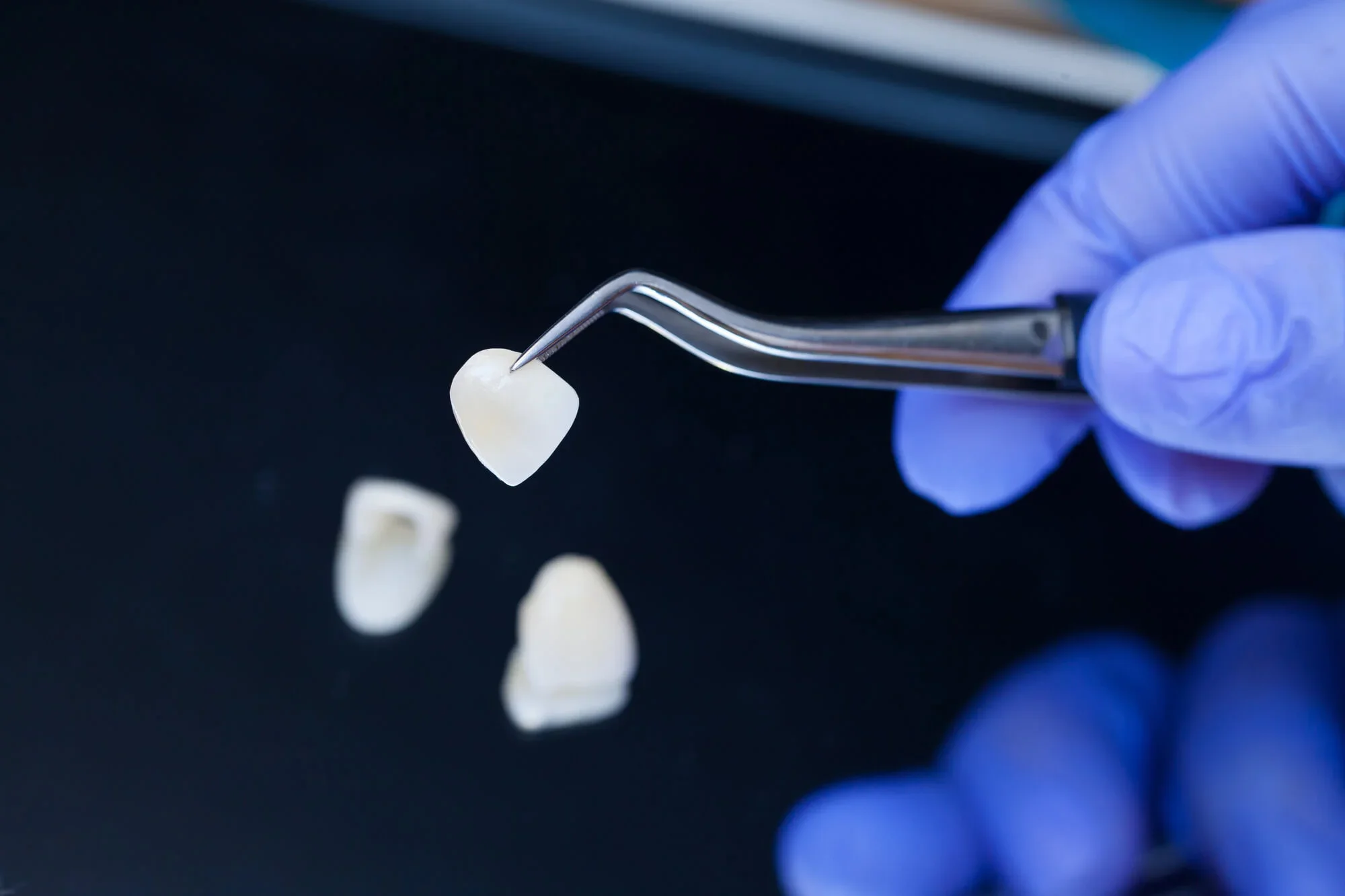 Dentist holding tools for veneers in Panama City, FL.