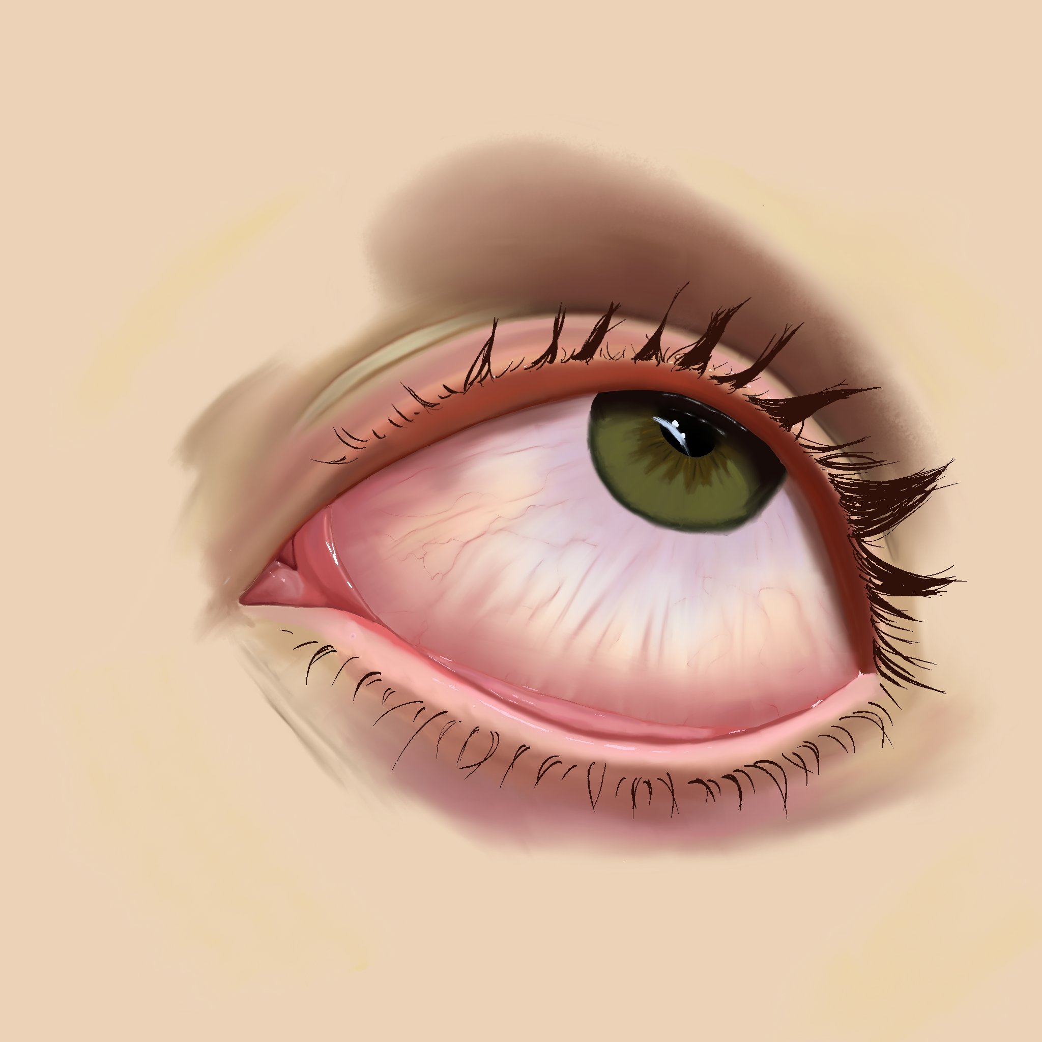 Irritation