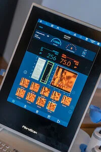 FibroScan Update 