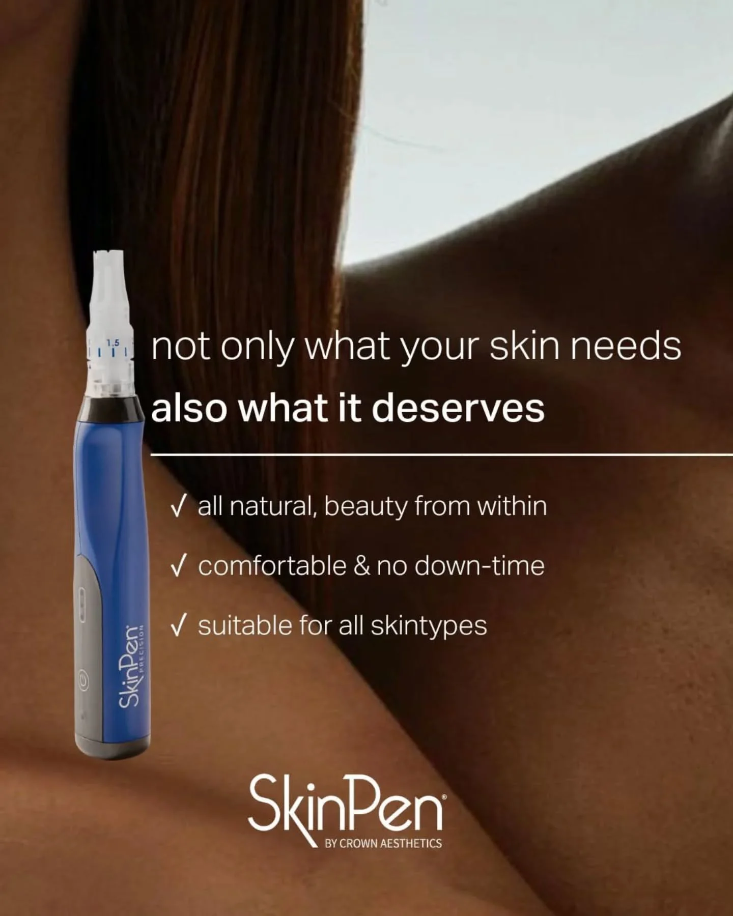 Microneedling med SkinPen handlar om att f&ouml;rb&auml;ttra hudens naturliga f&ouml;rnyelse. T&auml;nk j&auml;mnare hudstruktur, f&ouml;rfinade porer och den efterl&auml;ngtade glowen efter behandlingen ✨

Ge din hud det den f&ouml;rtj&auml;nar!

Re