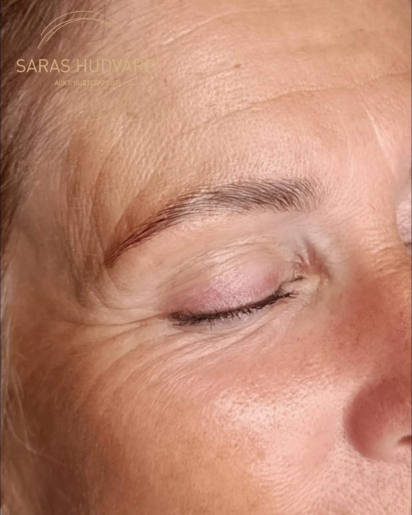 Brow lift 💙
