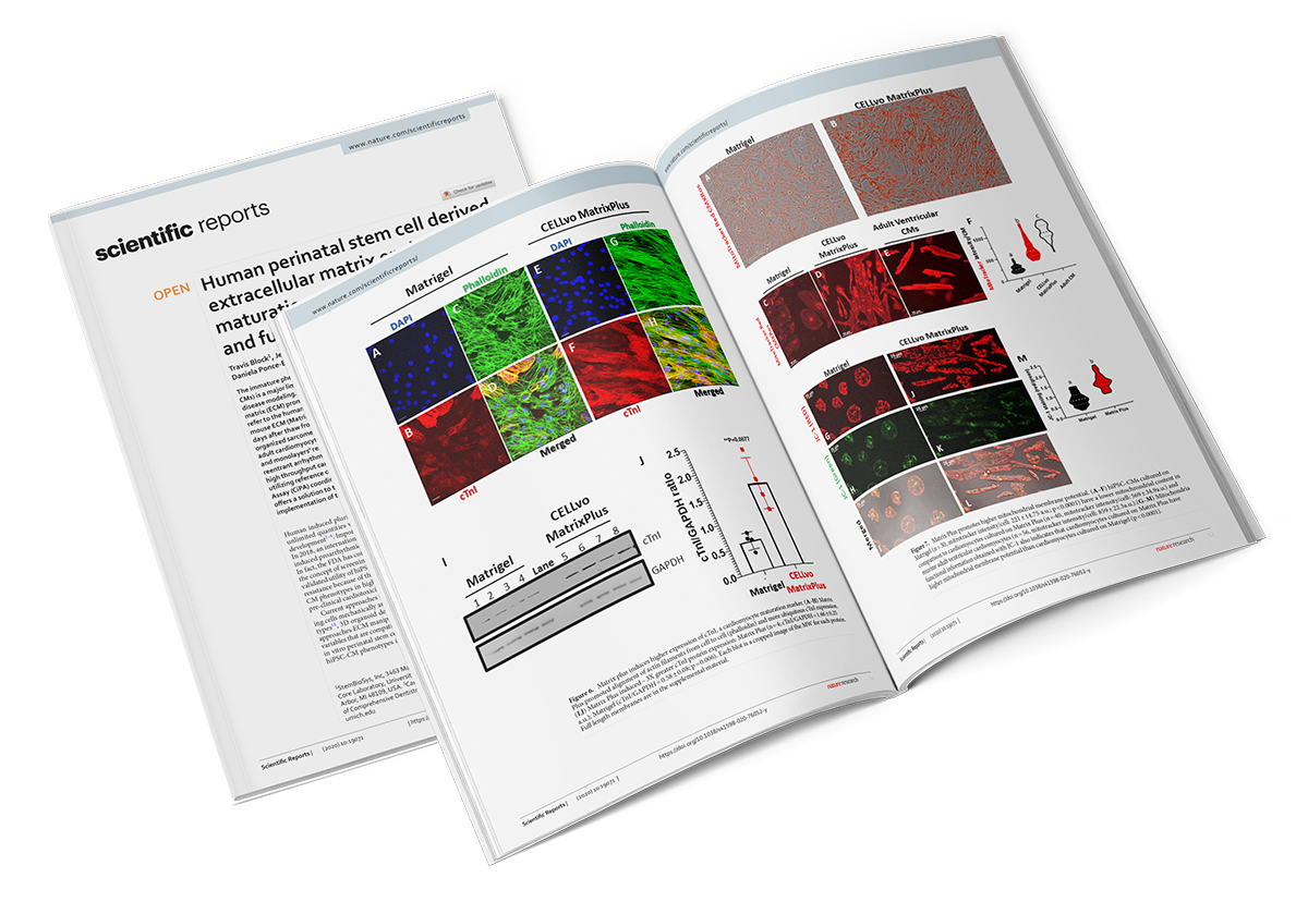 Human perinatal stem cell derived extracellular matrix enables rapid maturation of hiPSC-CM structural and functional phenotypes