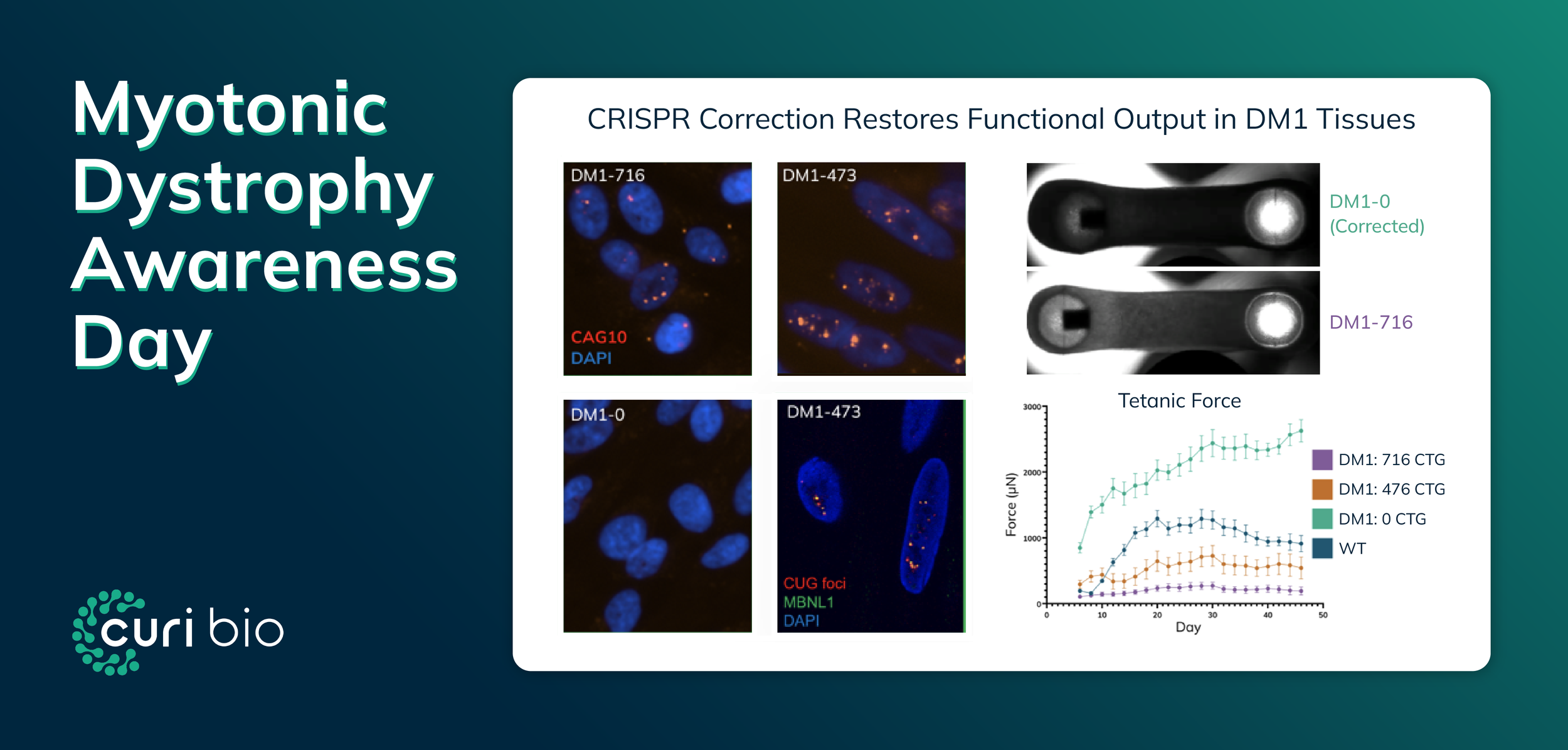 DM1 Still Has No Approved Disease-Modifying Treatments. Here's What 3D Human Muscle Tissue Reveals.