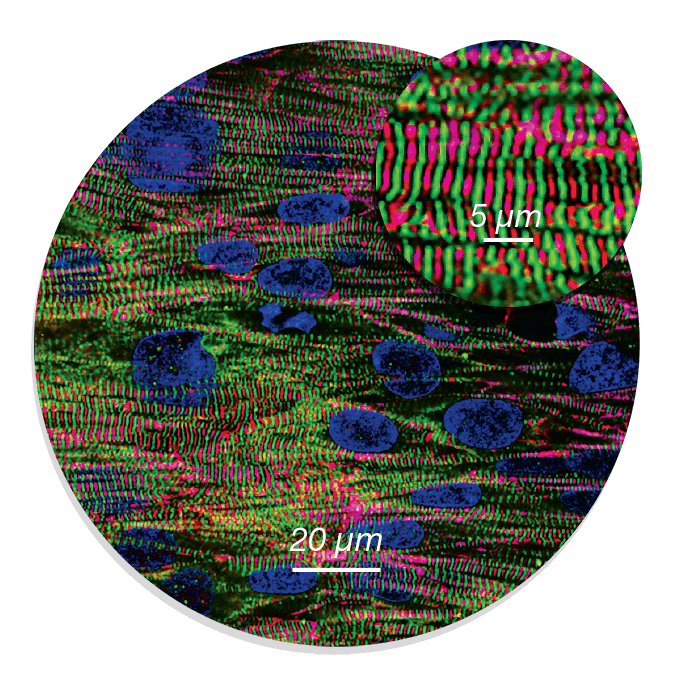 2D Heart Model (Copy)