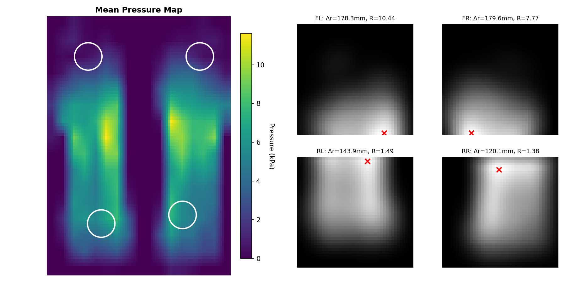 Pressure map of a foot with four marked points on heel and toe areas. Four smaller black and white heatmaps showing pressure distribution at those points with red crosses indicating specific locations.