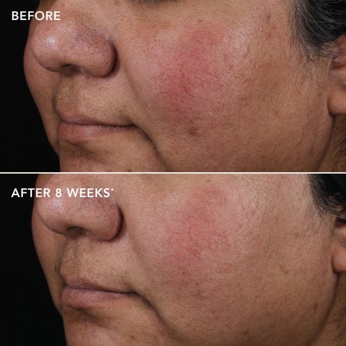Retinol034.jpg