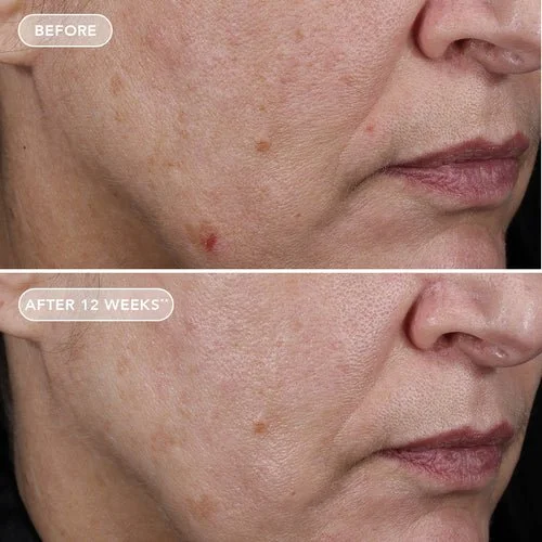 Retinol036.jpg