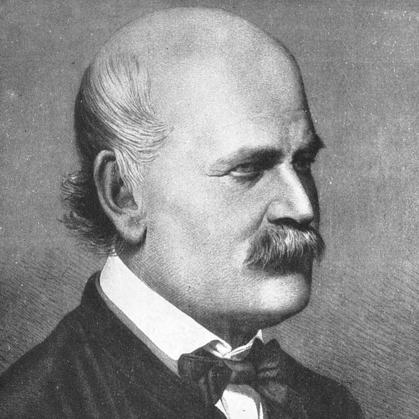 Ignaz Semmelweis (1818-1865)