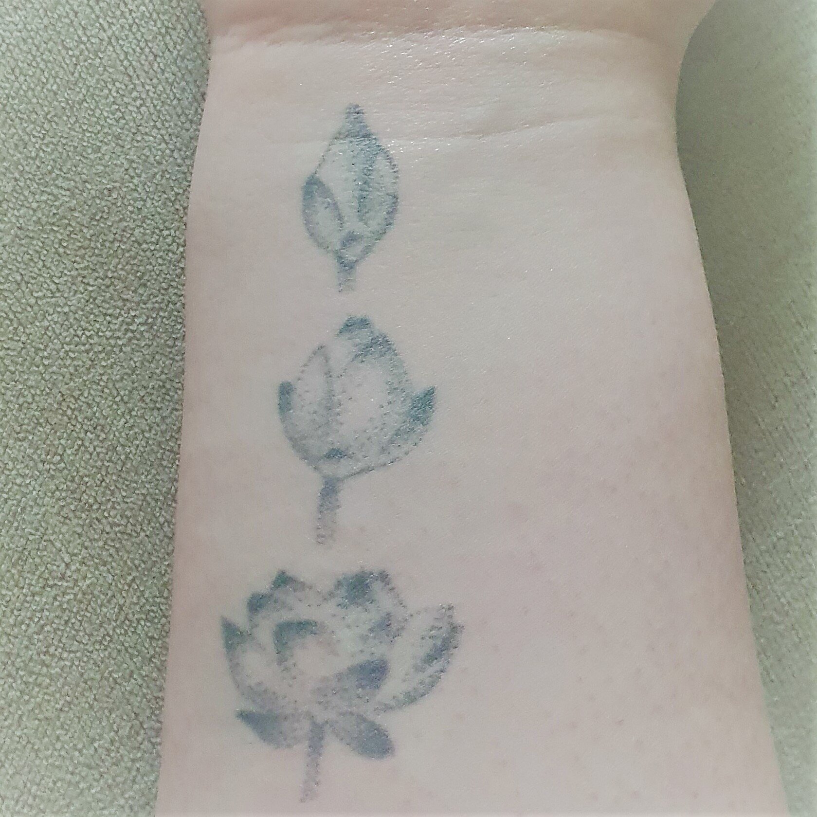 Before You Tattoo Over Your Self Harm Scars — Stabilising Serotonin