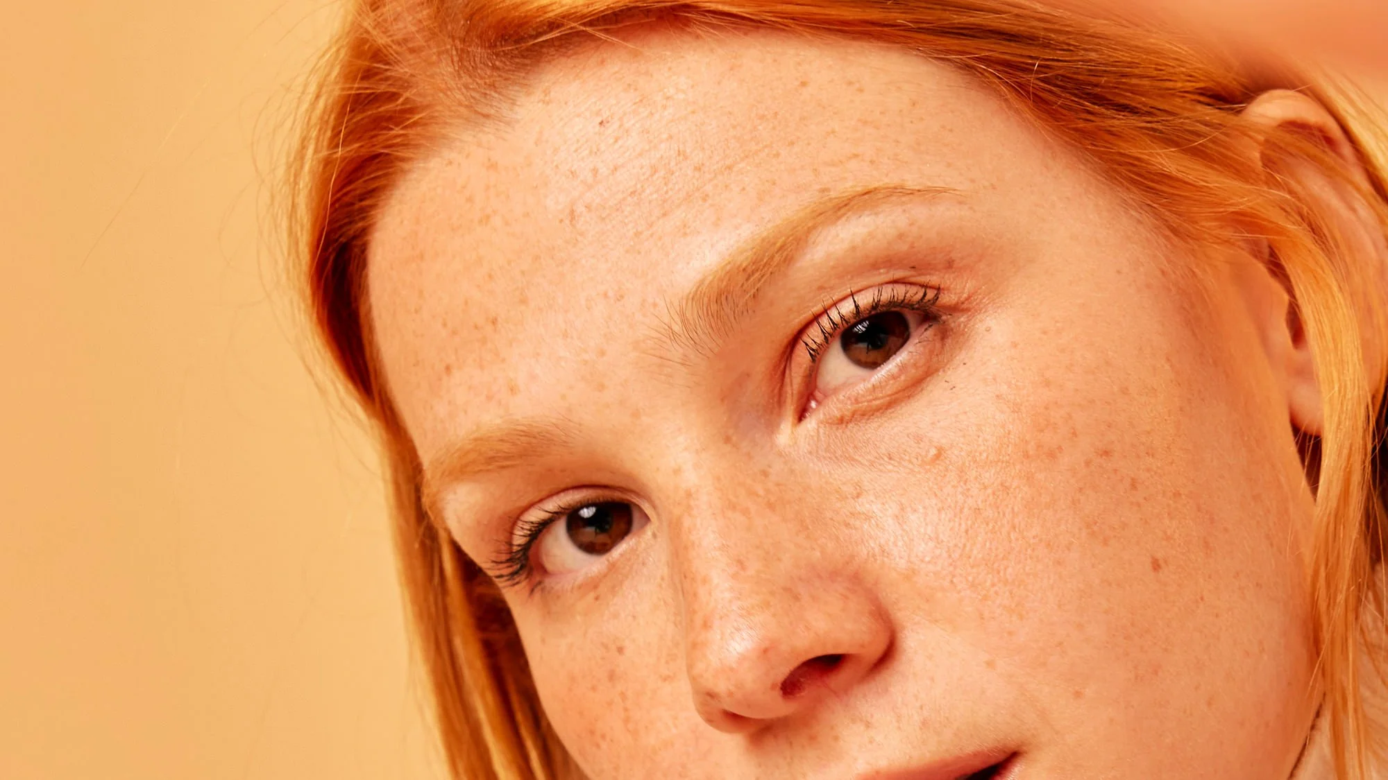 Close-up of a woman's smooth, line-free forehead and eye area after Botox treatment, showing natural-looking results with no visible wrinkles.