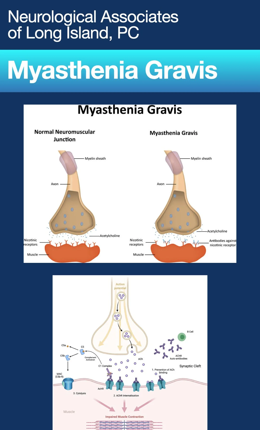 Myasthenia Gravis
