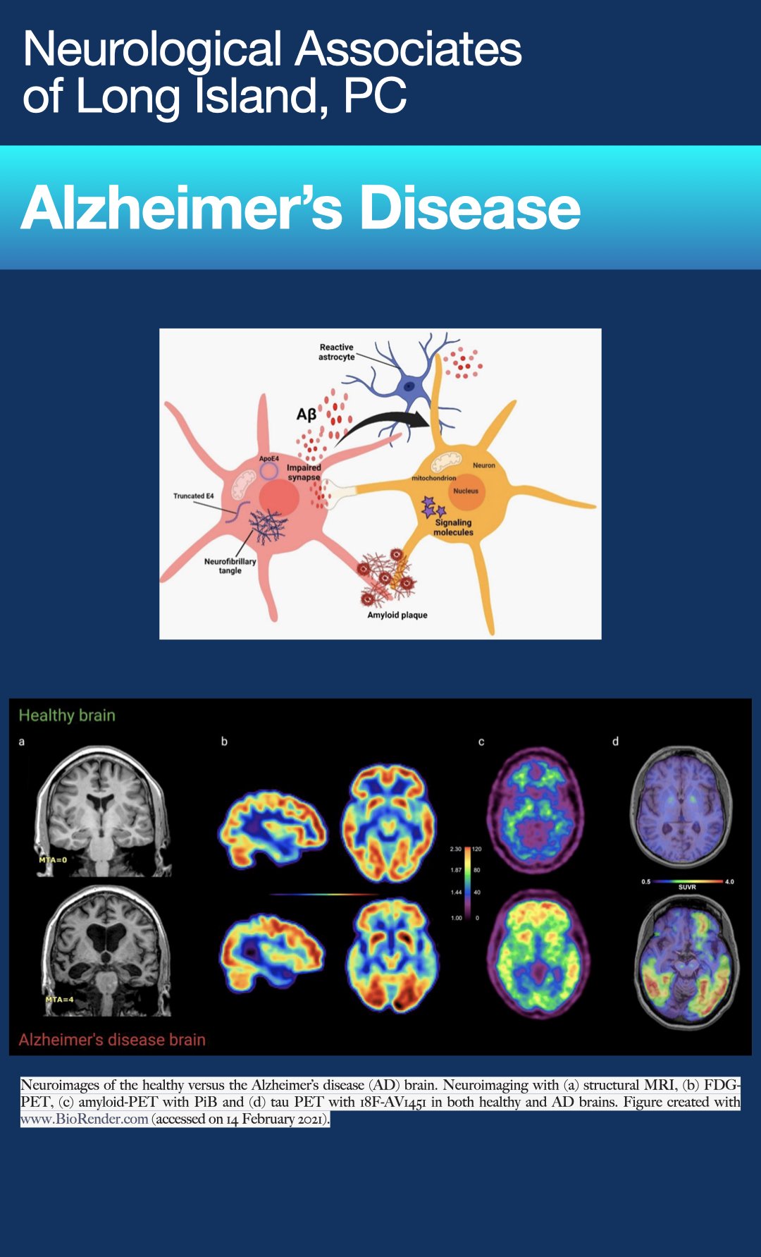 Leqembi Requirements