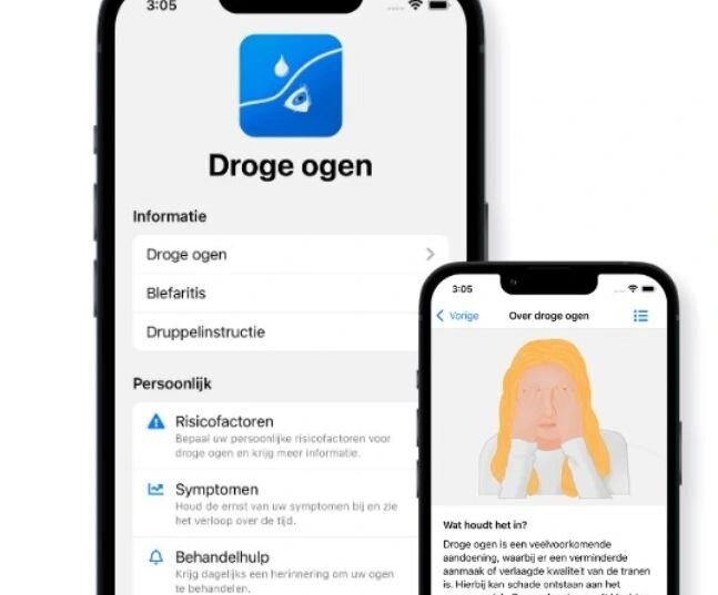 Vandaag lanceren Droge Ogen Kliniek Nederland, Santen en Buzzera de Droge Ogen App. Via de app kunnen een screening op risicofactoren van droge ogen gedaan worden, klachten worden bijgehouden en behandelingen worden geregistreerd. De uitkomsten van d