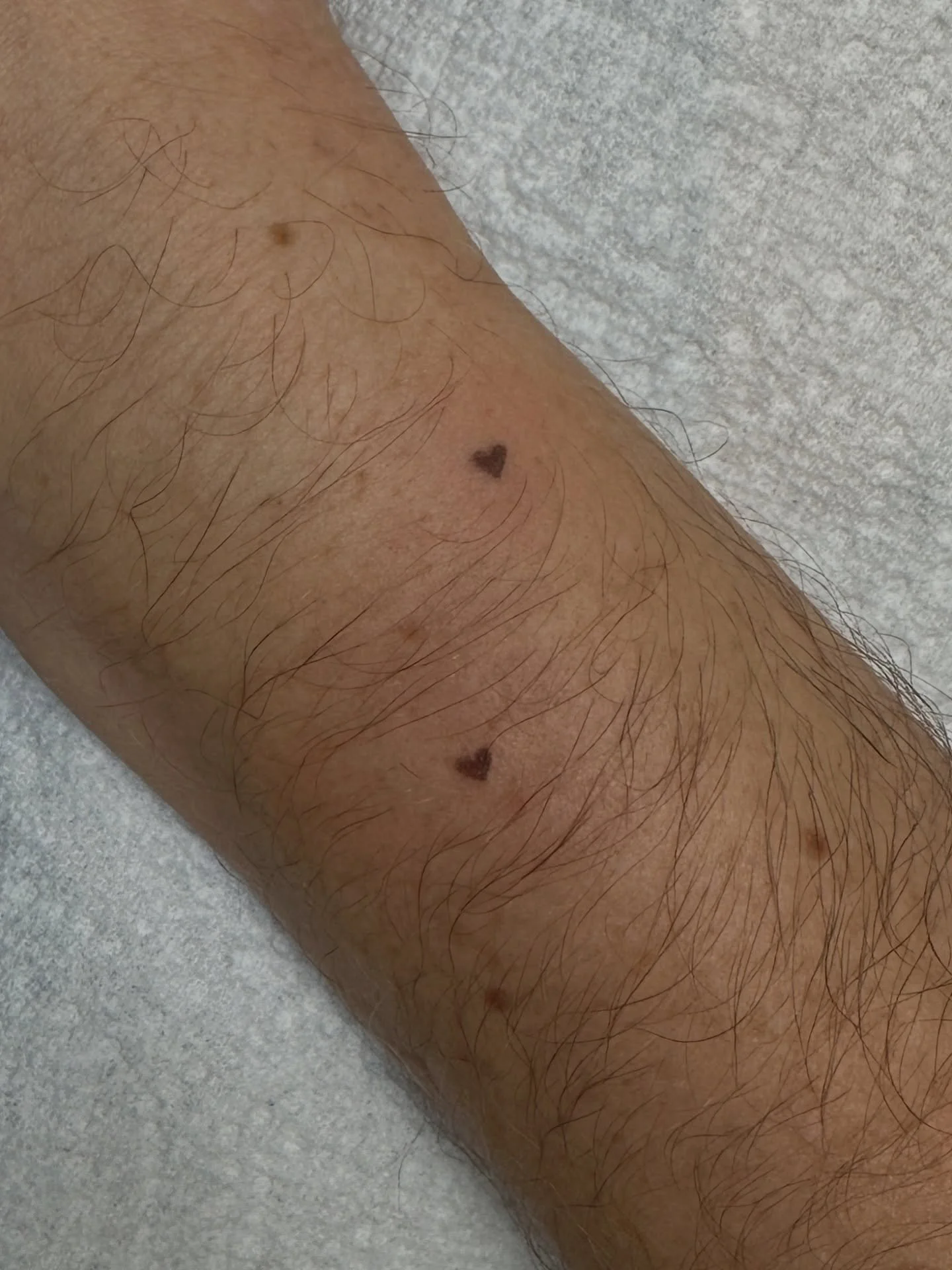 Semi permanent Heart Freckles 💕

⏱️30min session 1 freckle | 45 min 2 freckles 
💵 $75-135