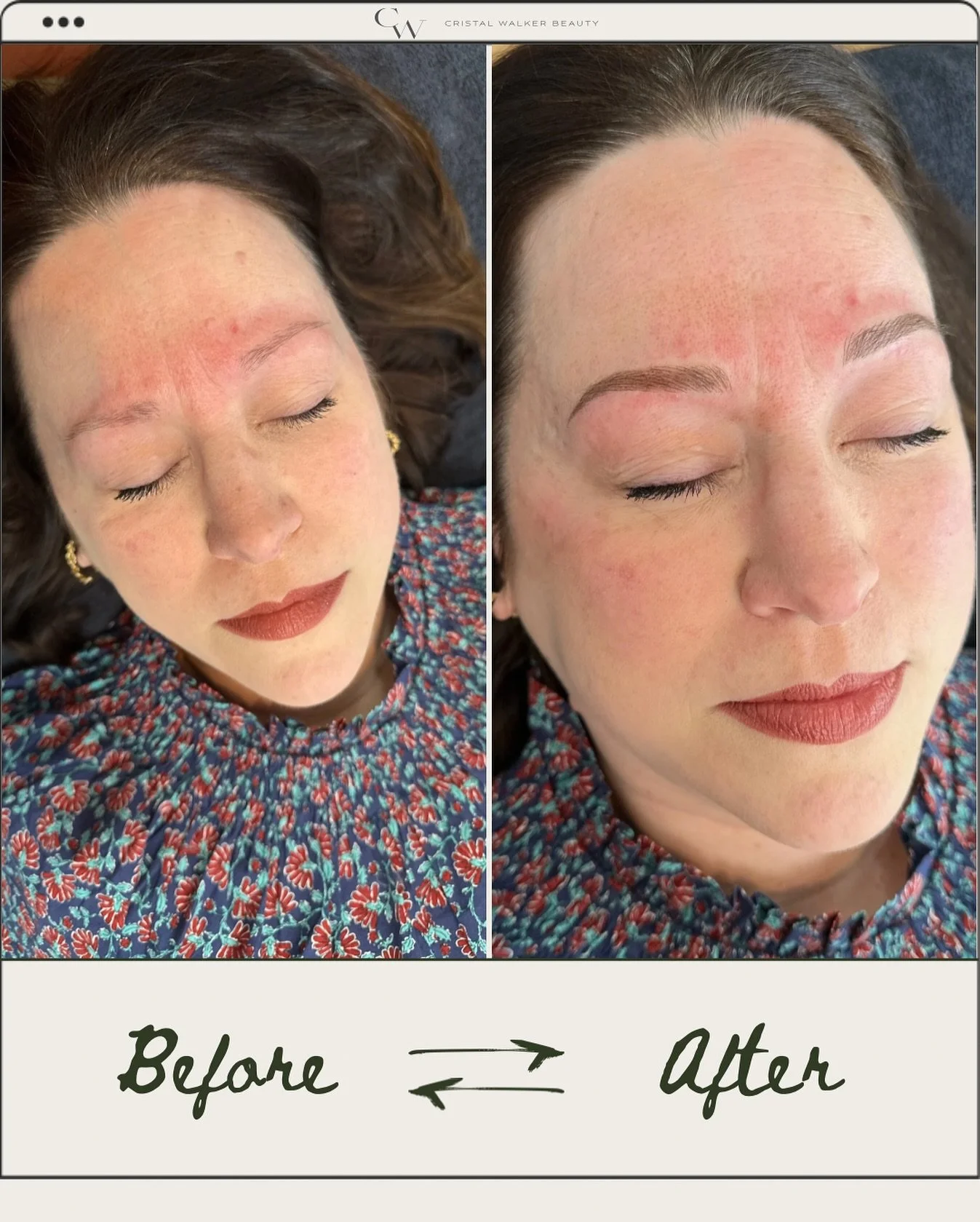 Subtle. Structured. Still you &mdash; just more defined.

This is what face-harmonized microblading looks like. No harsh lines, no overdone shapes &mdash; just brows that belong. Subtle shading in between hair strokes to the areas that need more dens